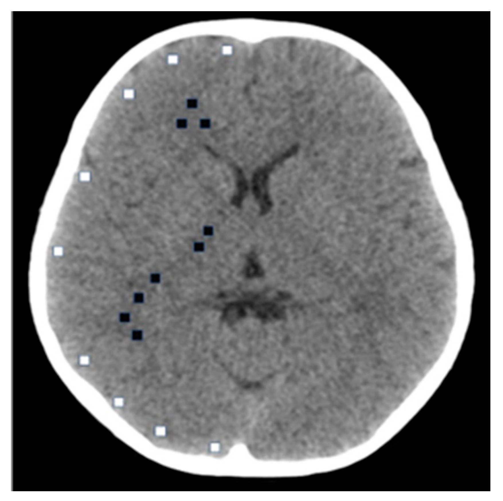 Tomography 11 00119 g002 Tomography 11 00119 g002