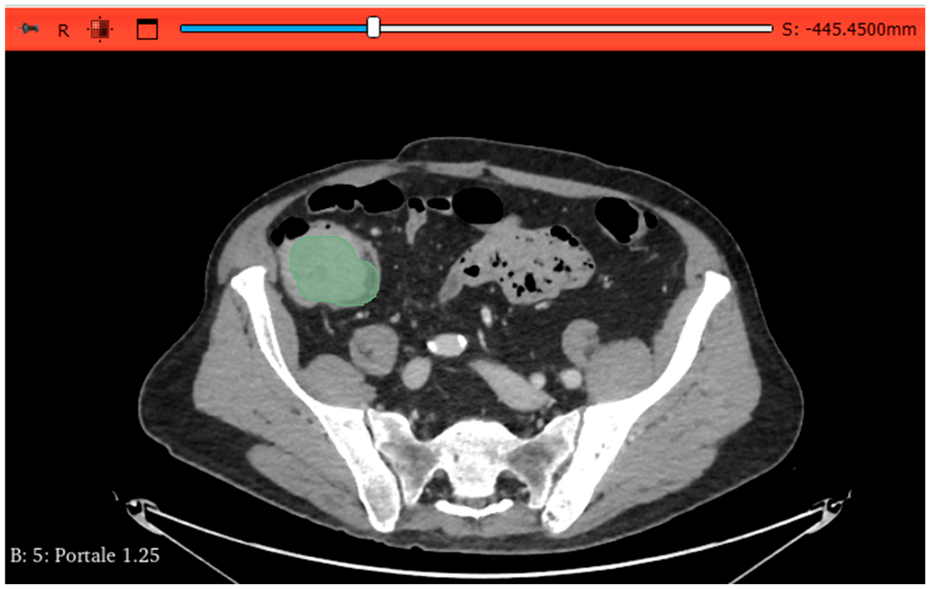 Tomography 11 00126 g004 Tomography 11 00126 g004