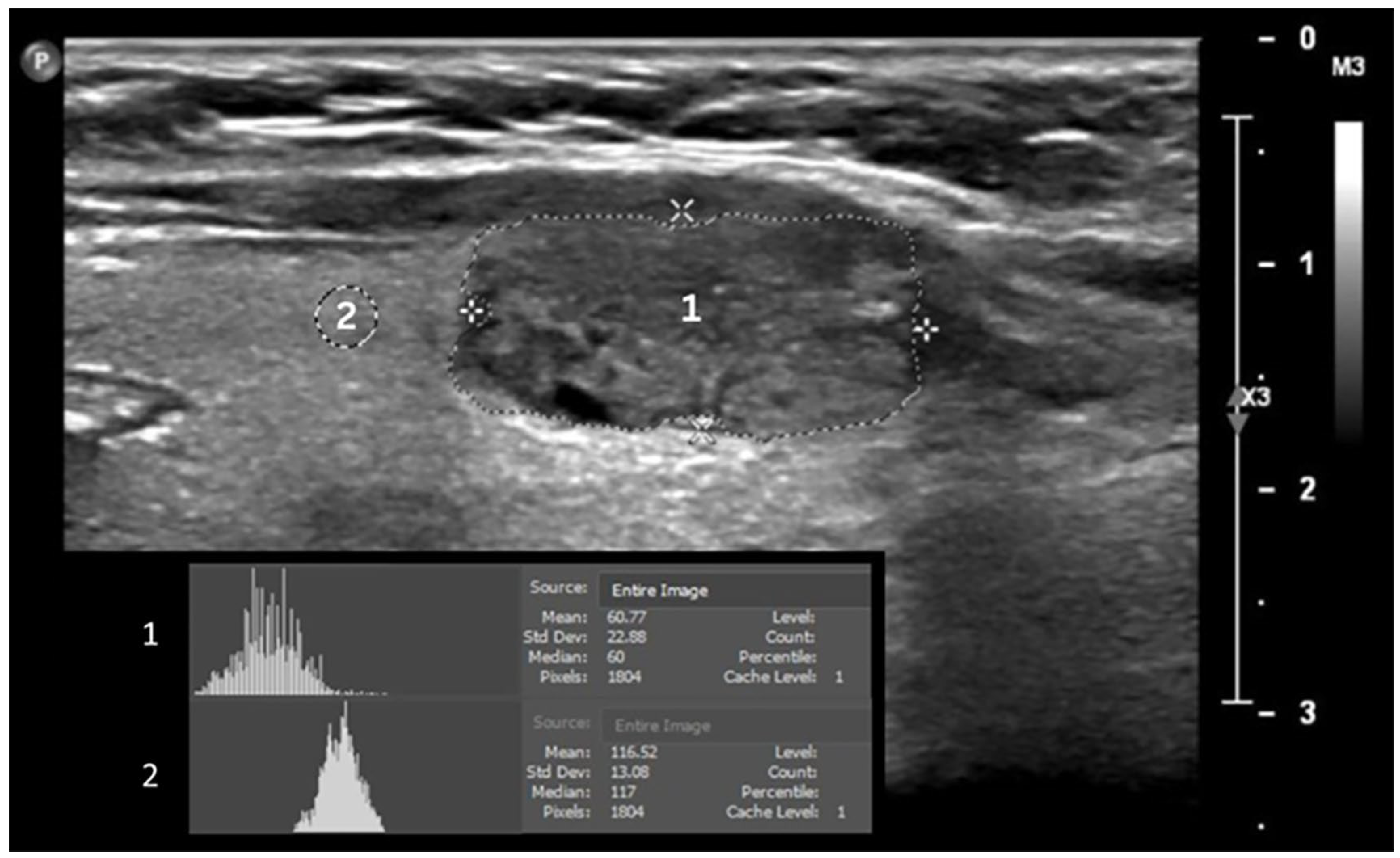 Tomography 11 00133 g001