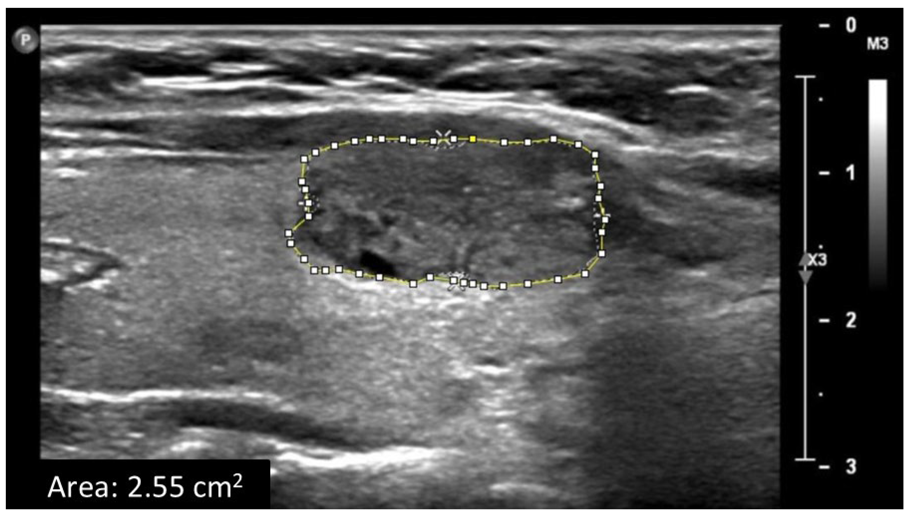 Tomography 11 00133 g002
