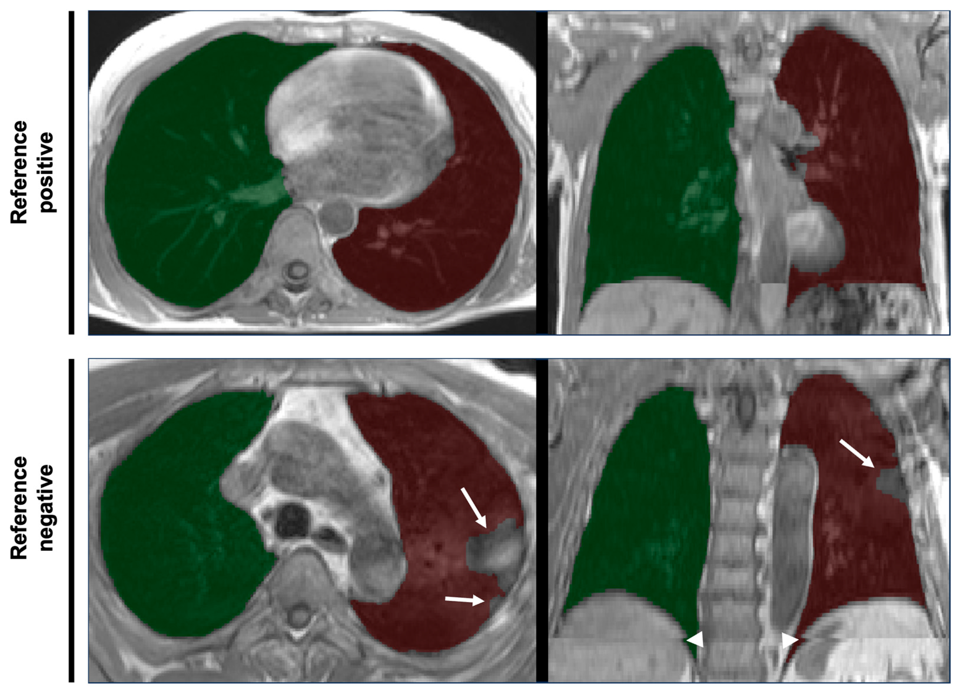 Tomography 11 00135 g001