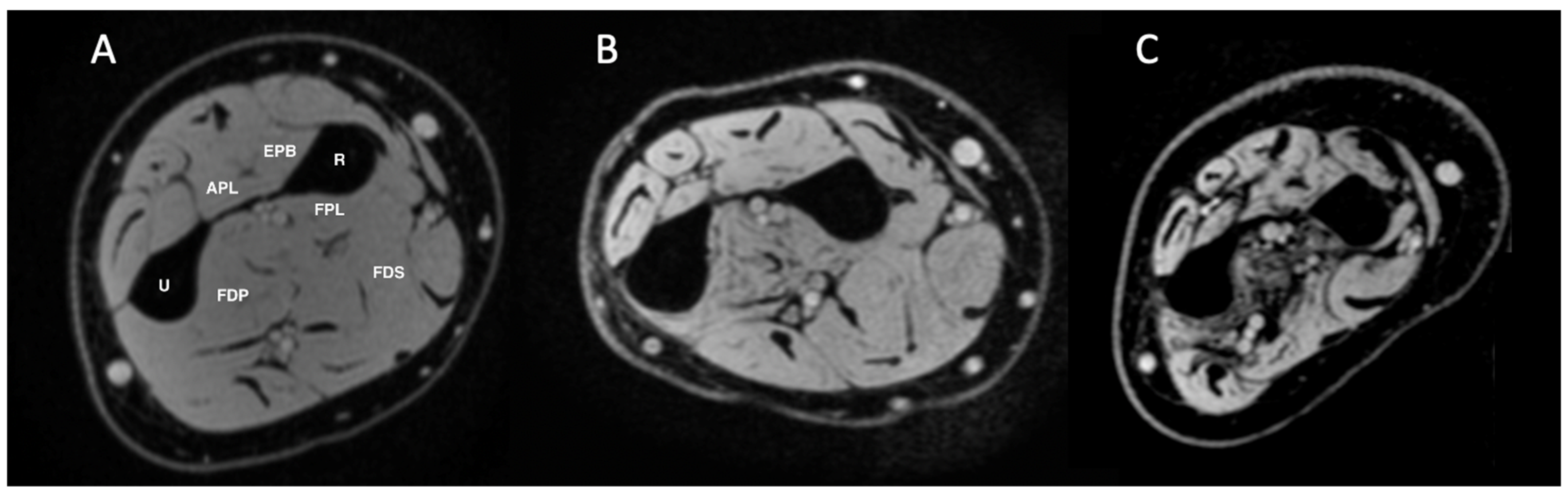 Tomography 11 00136 g001 Tomography 11 00136 g001