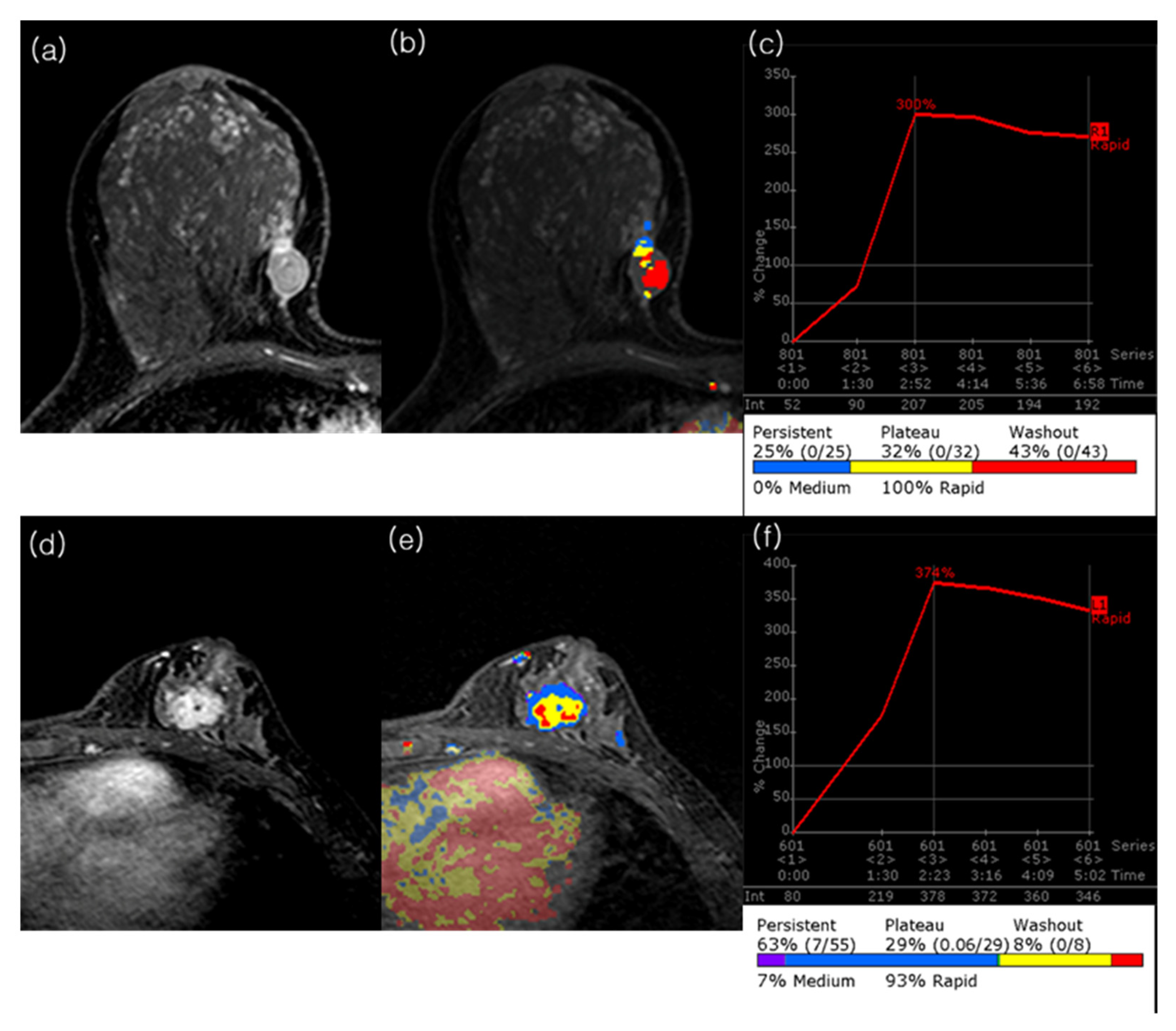 Tomography 11 00137 g003 Tomography 11 00137 g003