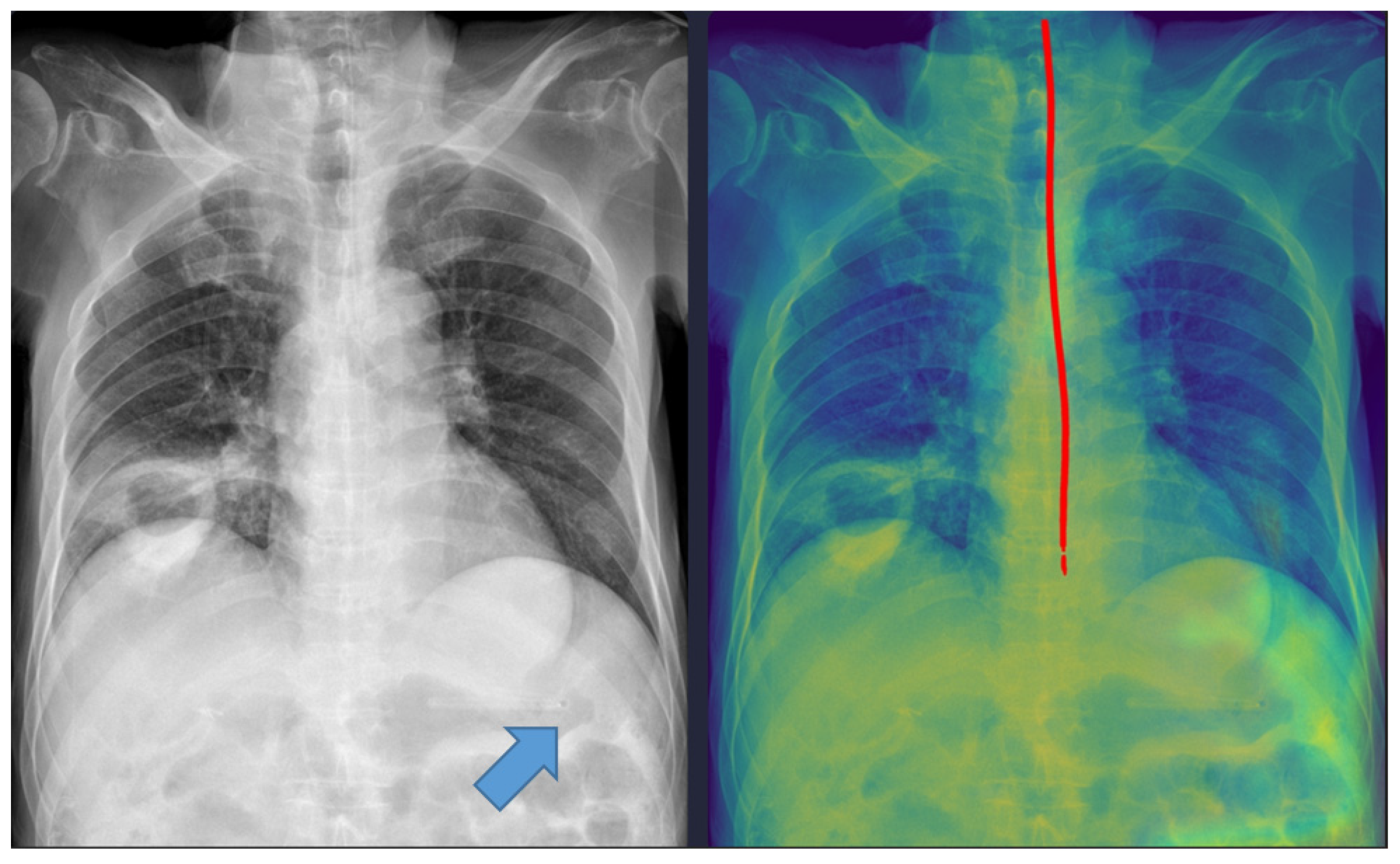 Tomography 11 00140 g003