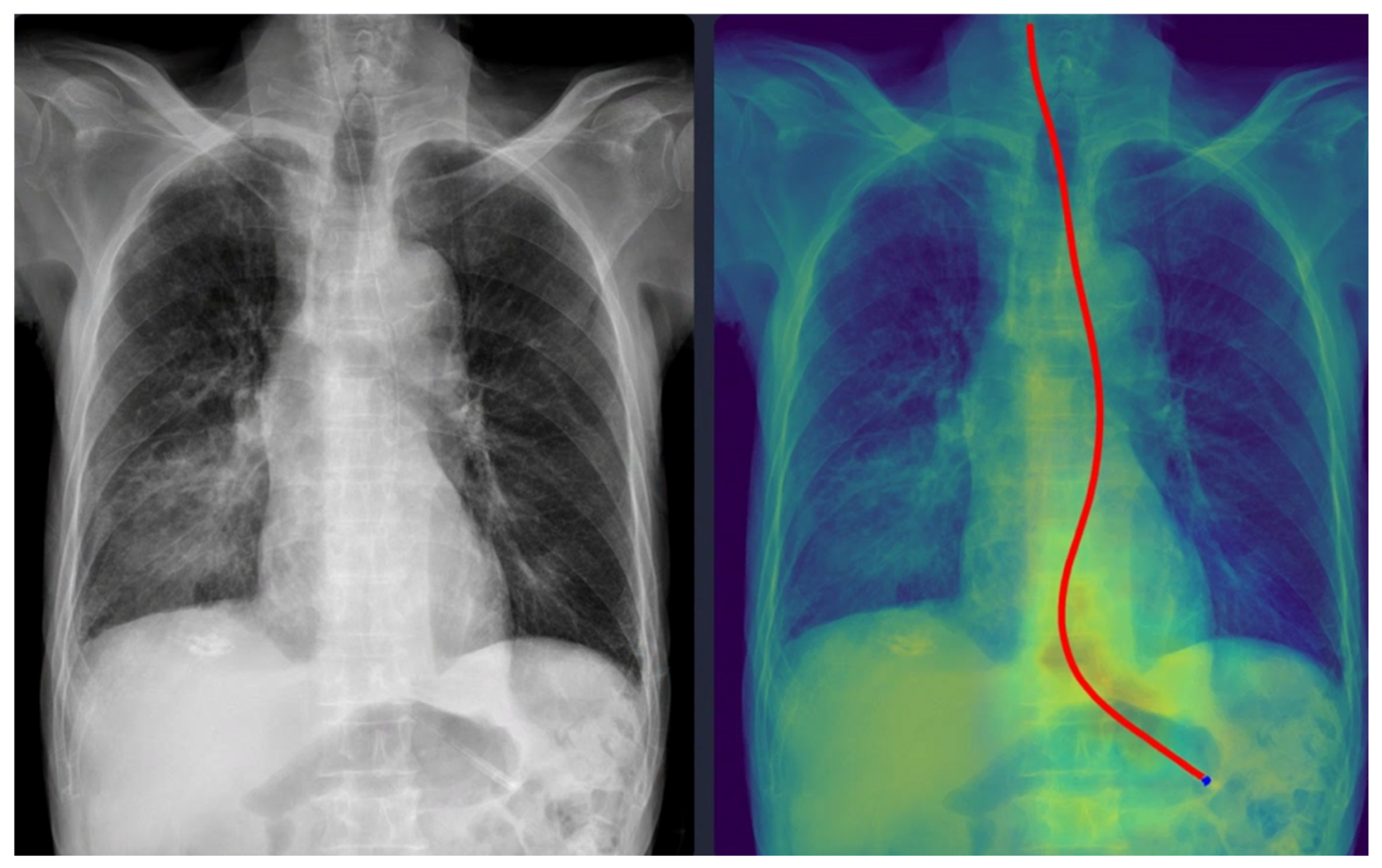 Tomography 11 00140 g004