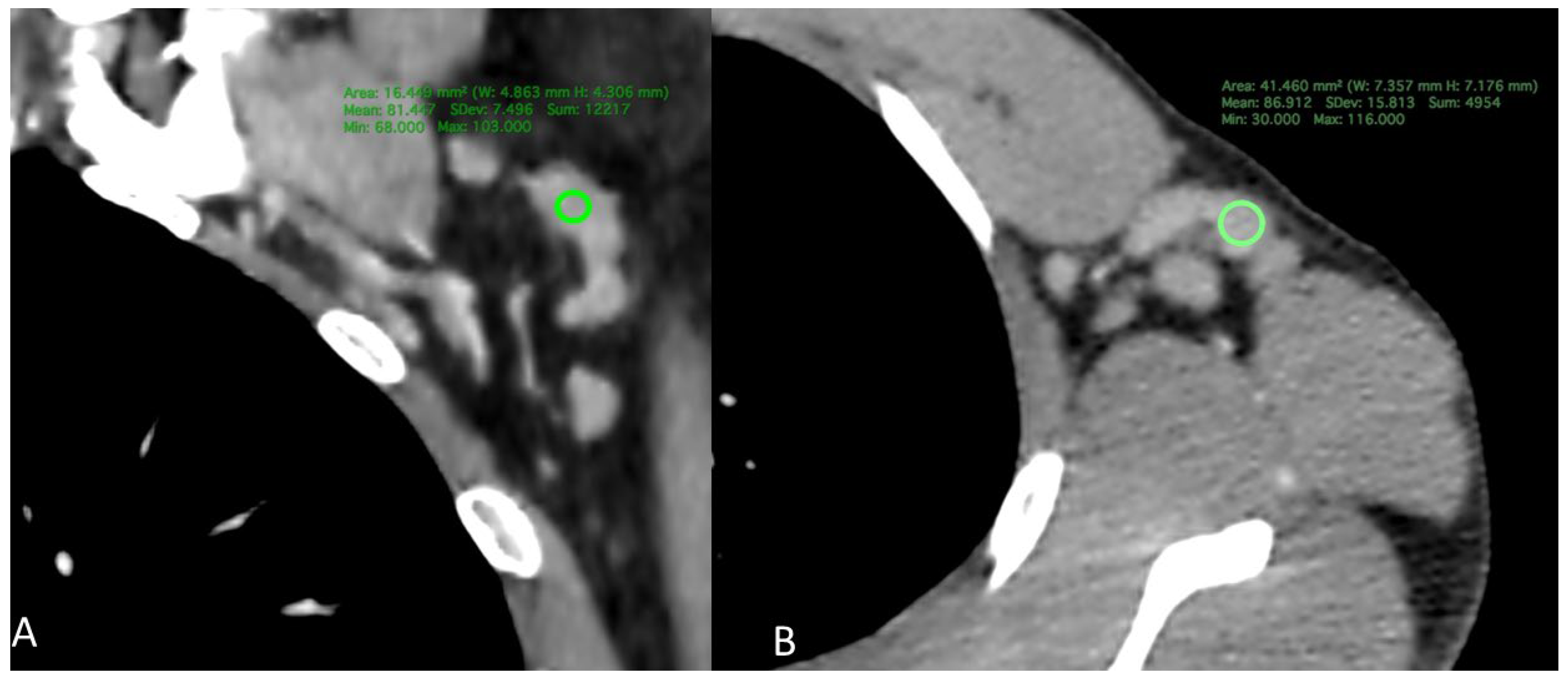 Tomography 12 00003 g002
