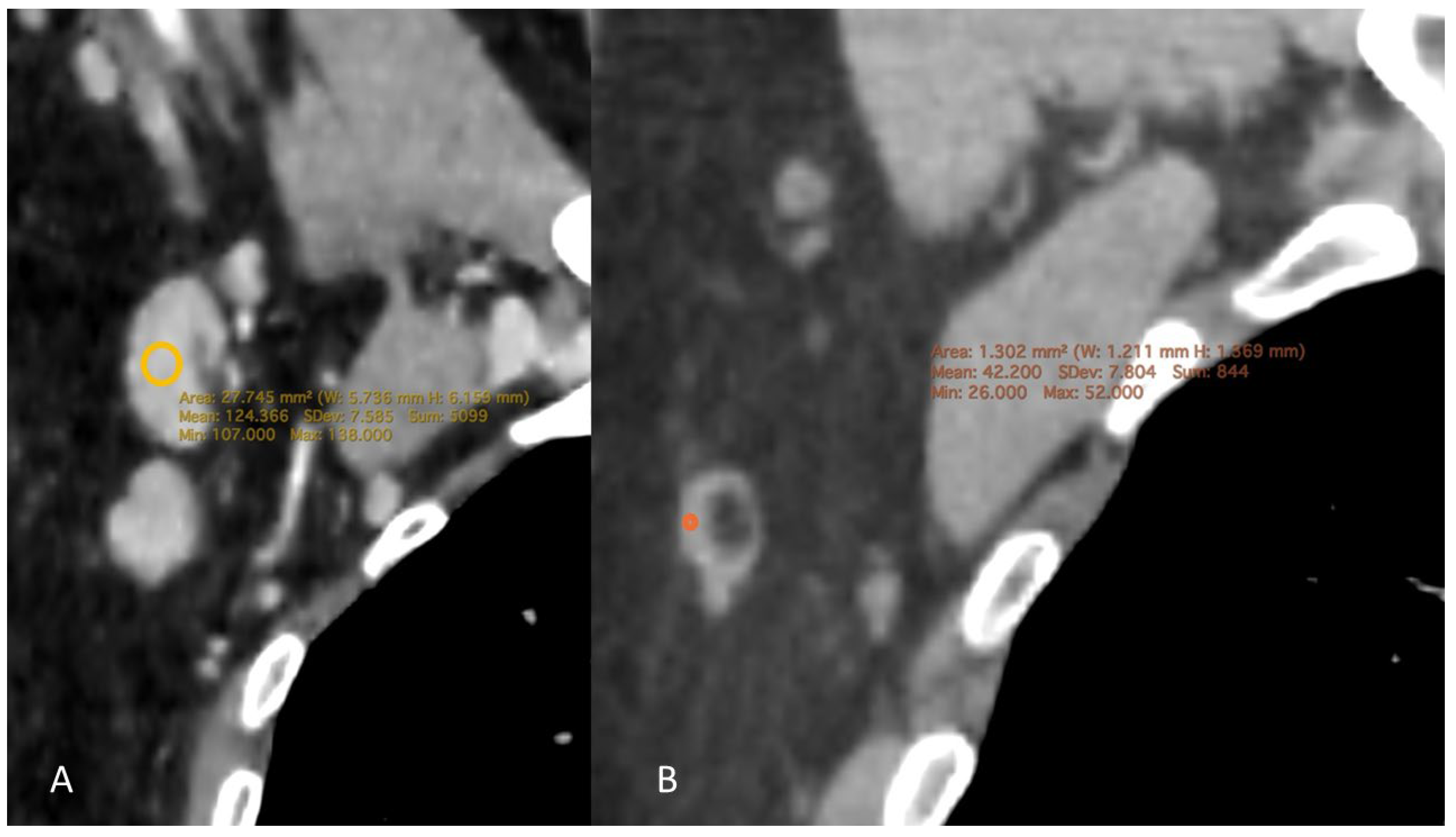 Tomography 12 00003 g006