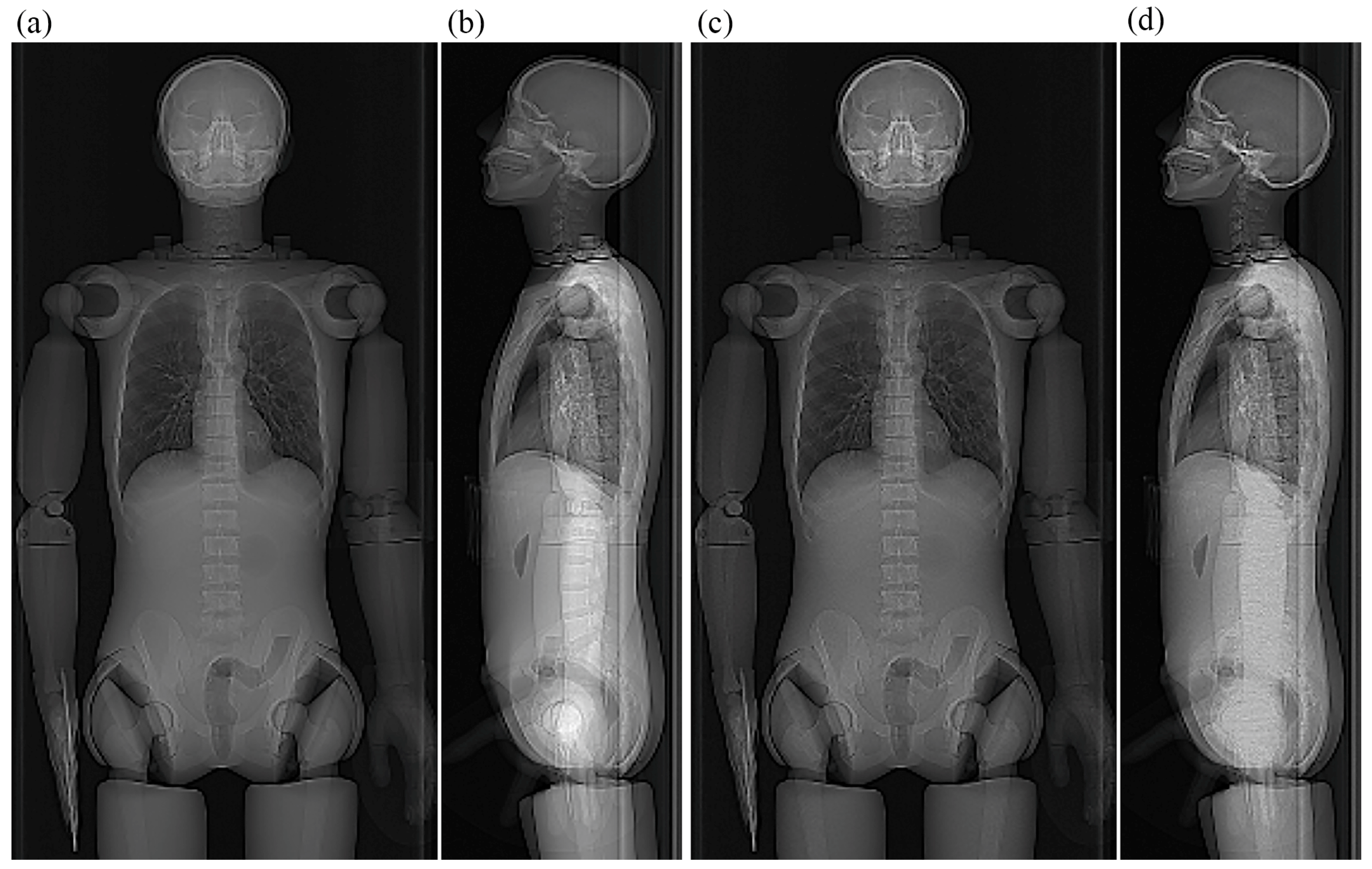 Tomography 12 00005 g009
