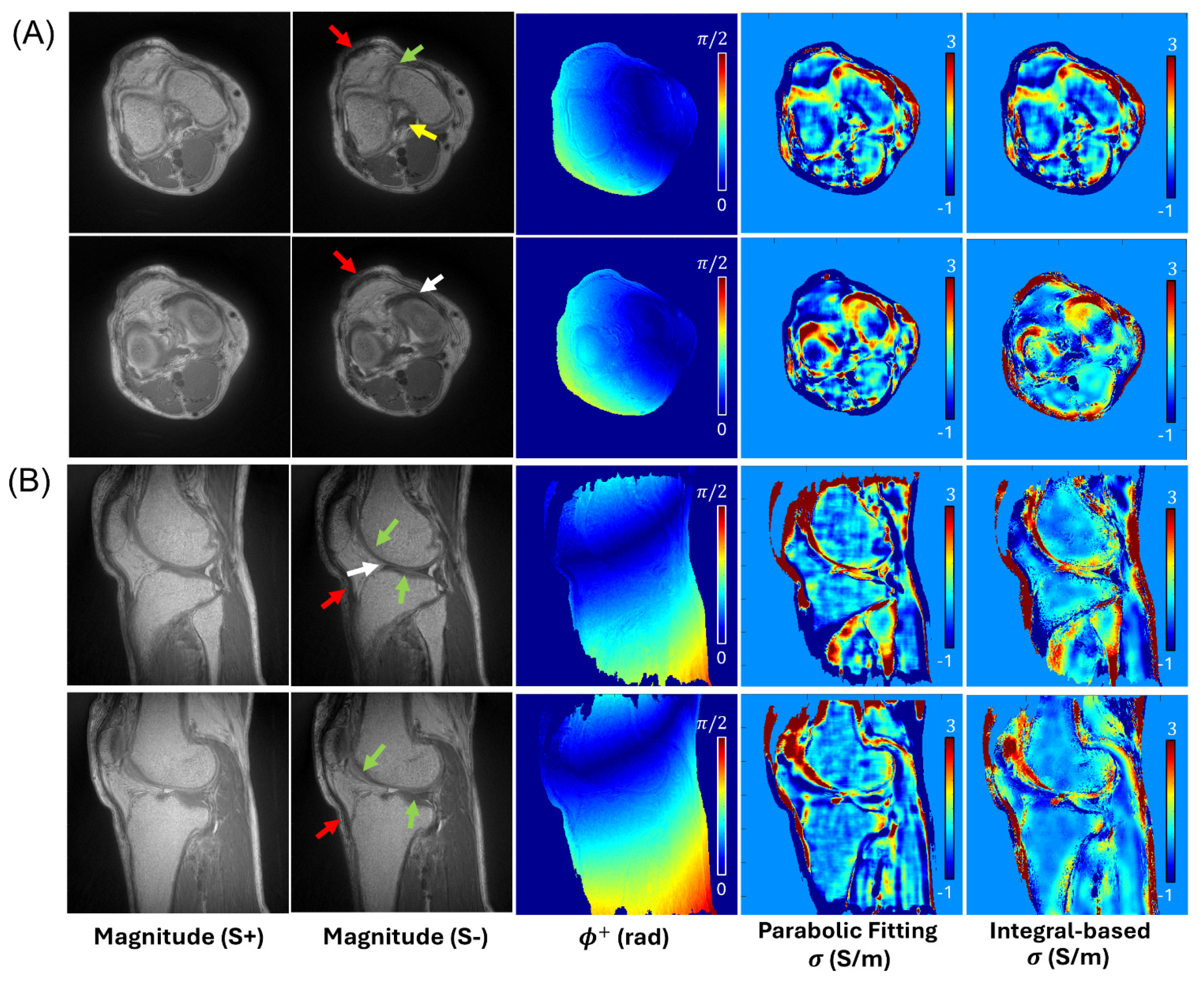 Tomography 12 00018 g003