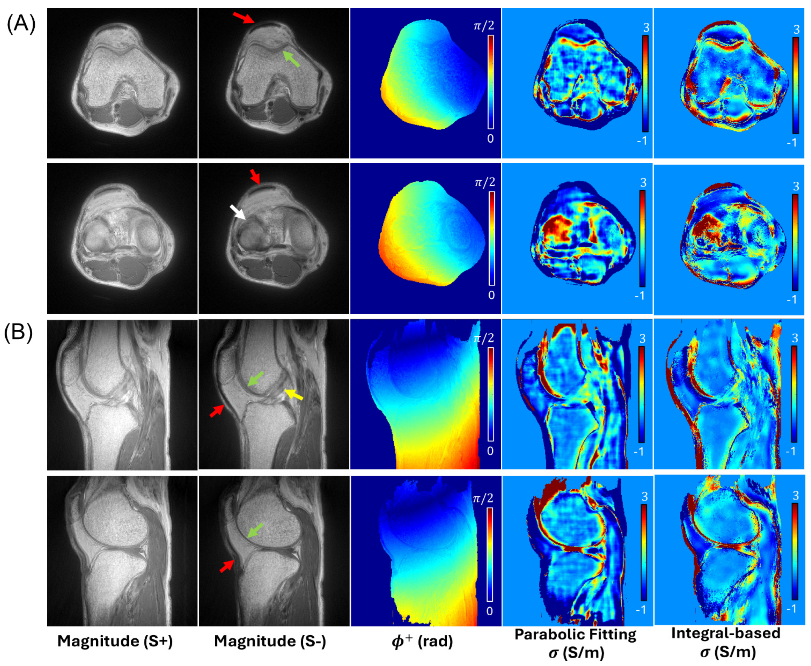 Tomography 12 00018 g004