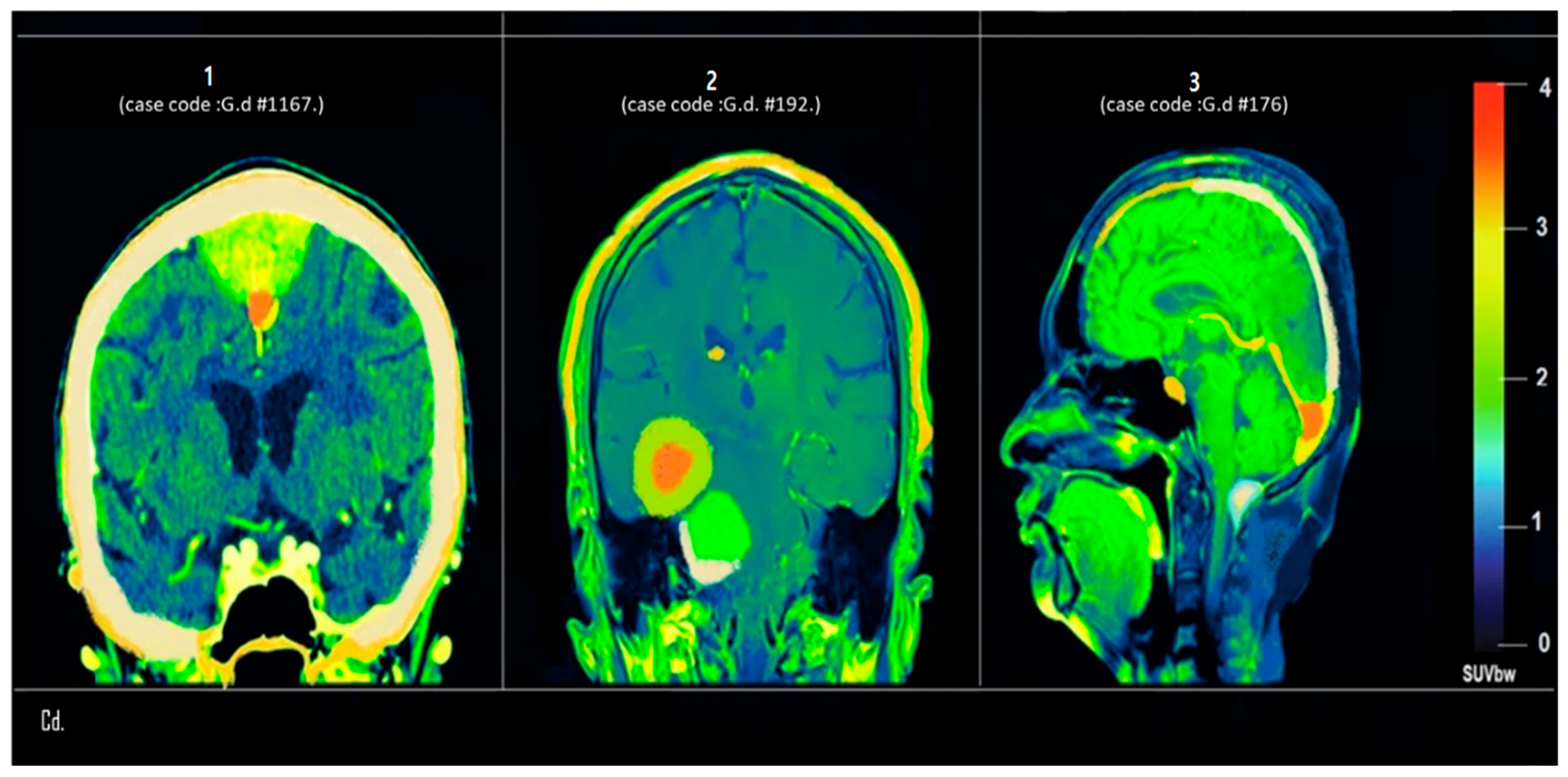 Tomography 12 00020 g005