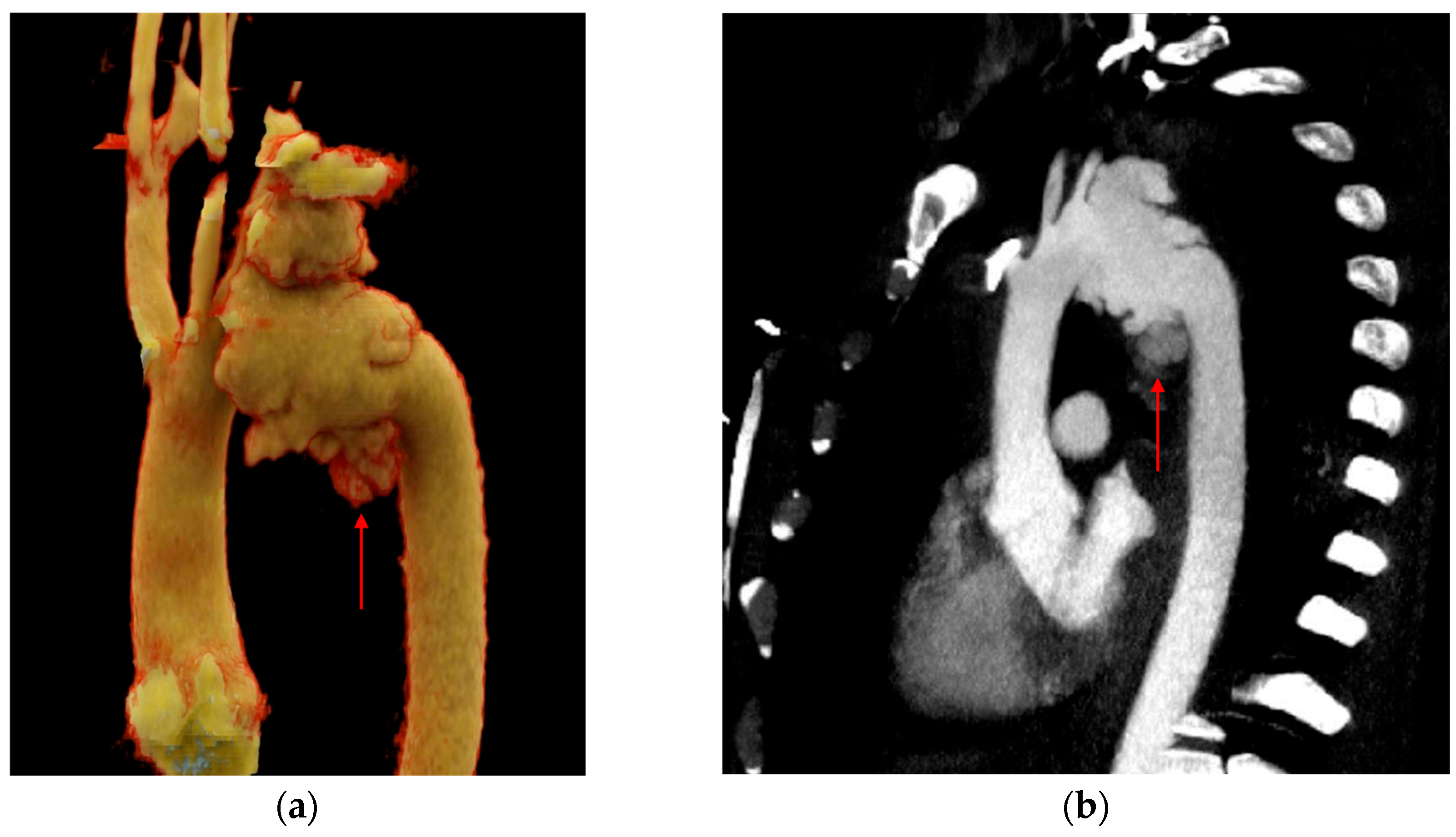 Tomography 12 00057 g005
