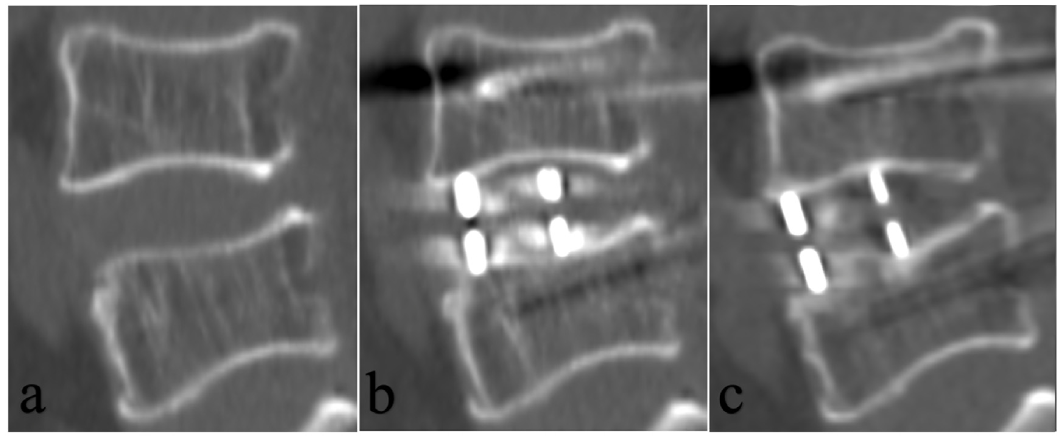 Tomography 12 00072 g005 Tomography 12 00072 g005