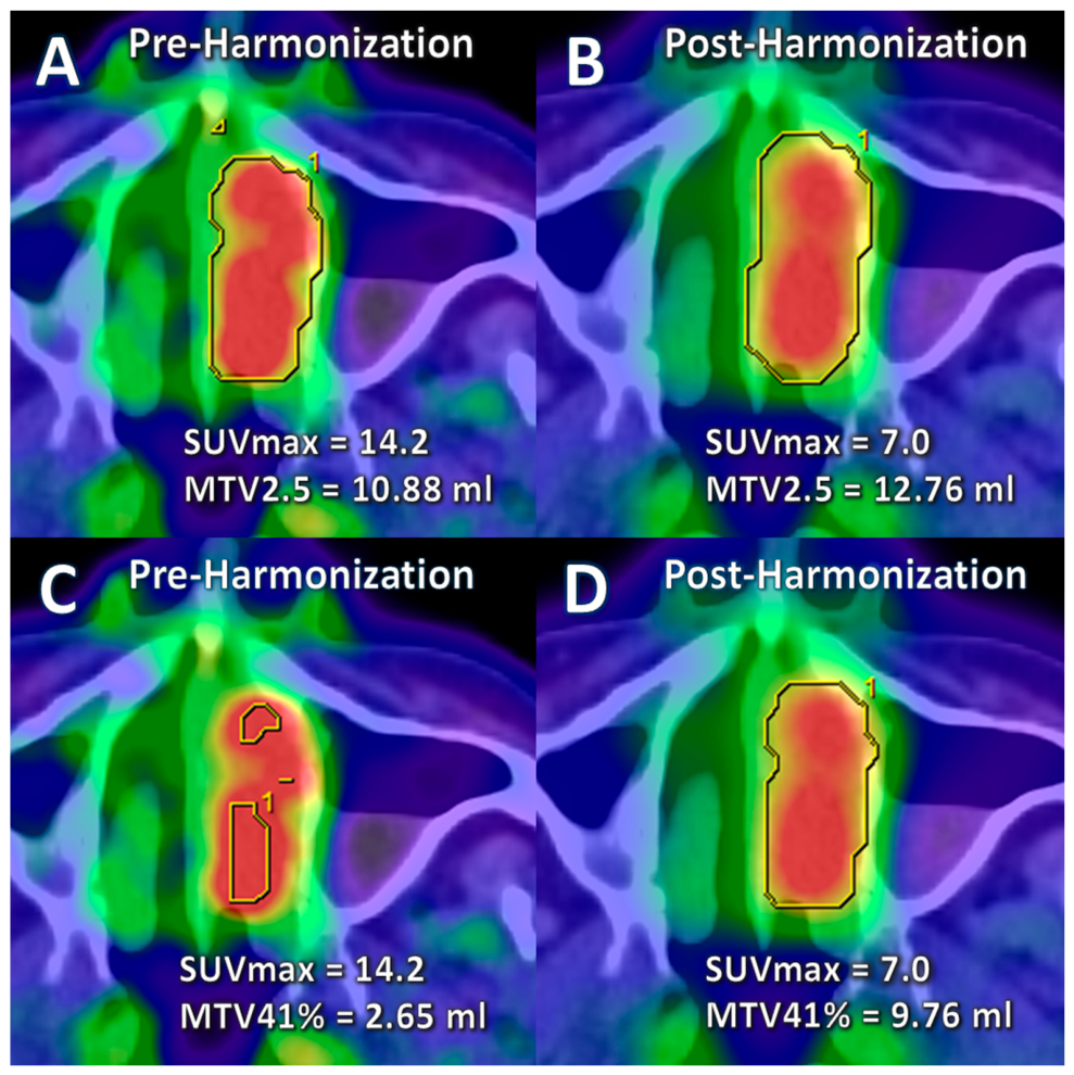 Tomography 12 00104 g002 Tomography 12 00104 g002