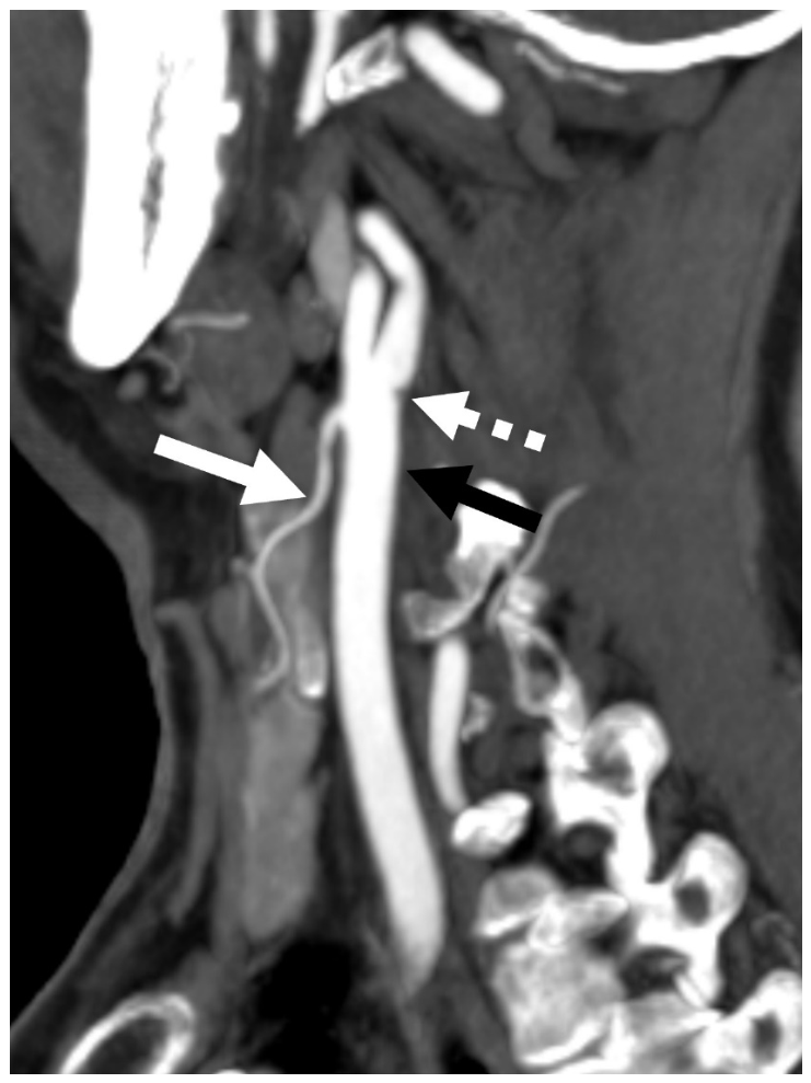 Tomography 12 00111 g014