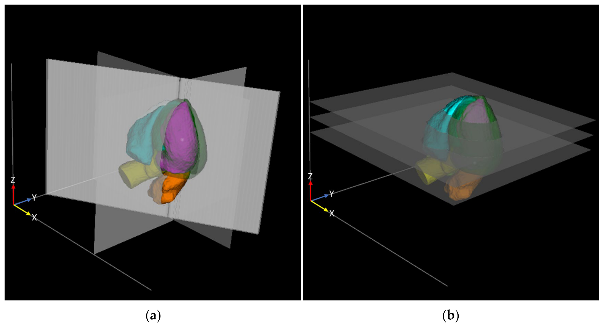 Tomography 12 00114 g002