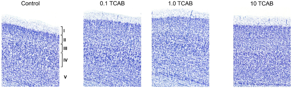 Toxics 02 00496 g007 1024