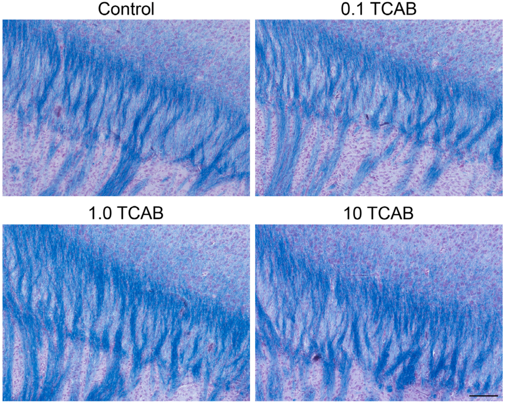 Toxics 02 00496 g008 1024