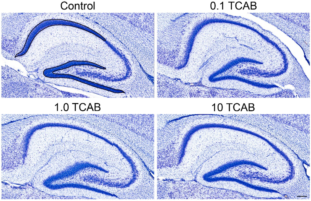 Toxics 02 00496 g010 1024