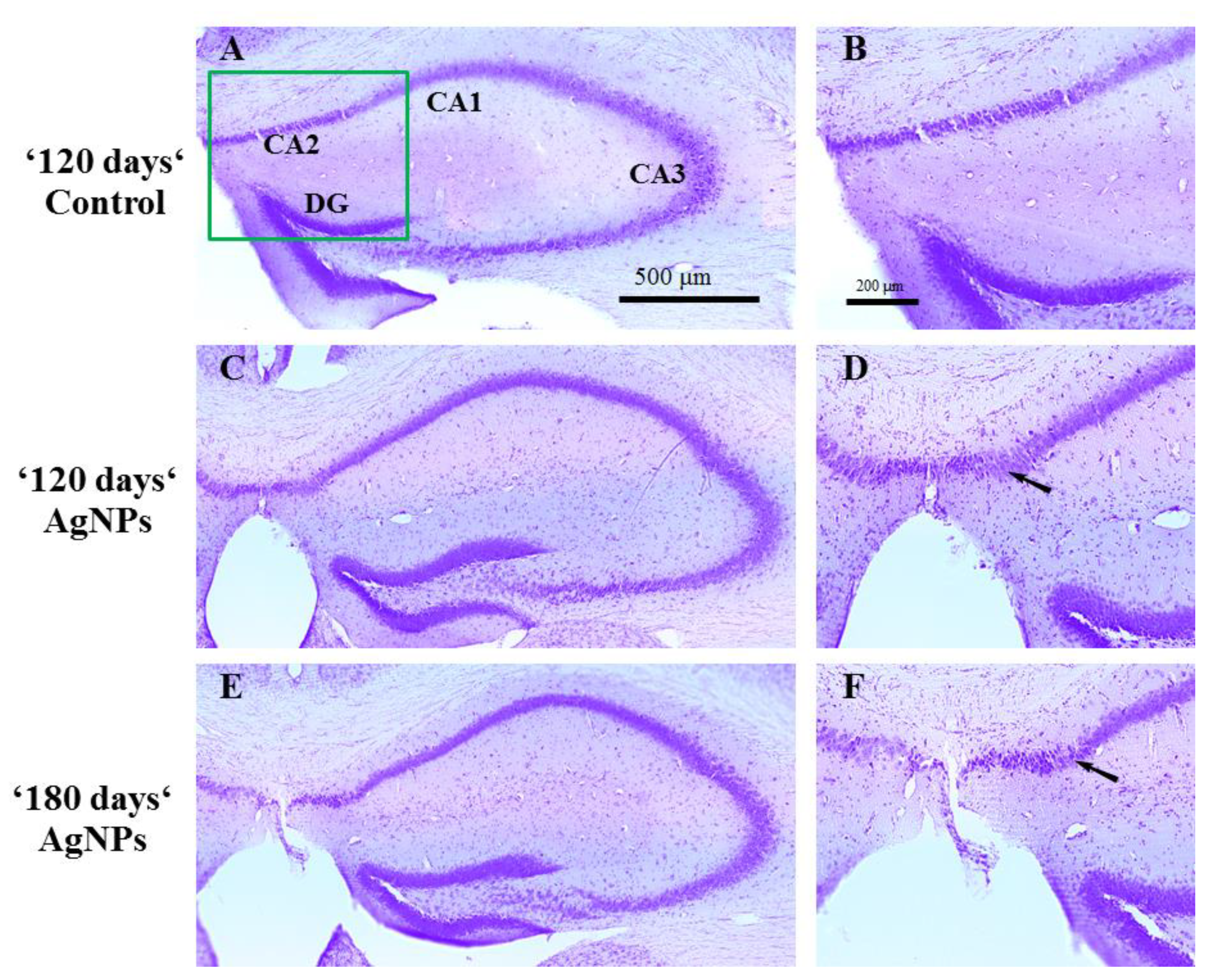 Toxics 09 00030 g005