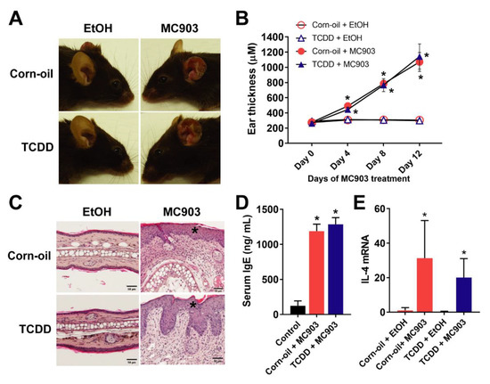 Toxics Free Full Text Cutaneous Effects Of In Utero And Lactational Exposure Of C57bl 6j Mice To 2 3 7 8 Tetrachlorodibenzo P Dioxin Html Toxics Free Full Text Cutaneous Effects Of In Utero And Lactational Exposure Of C57bl 6j Mice To 2 3 7 8 Tetrachlorodibenzo P Dioxin Html