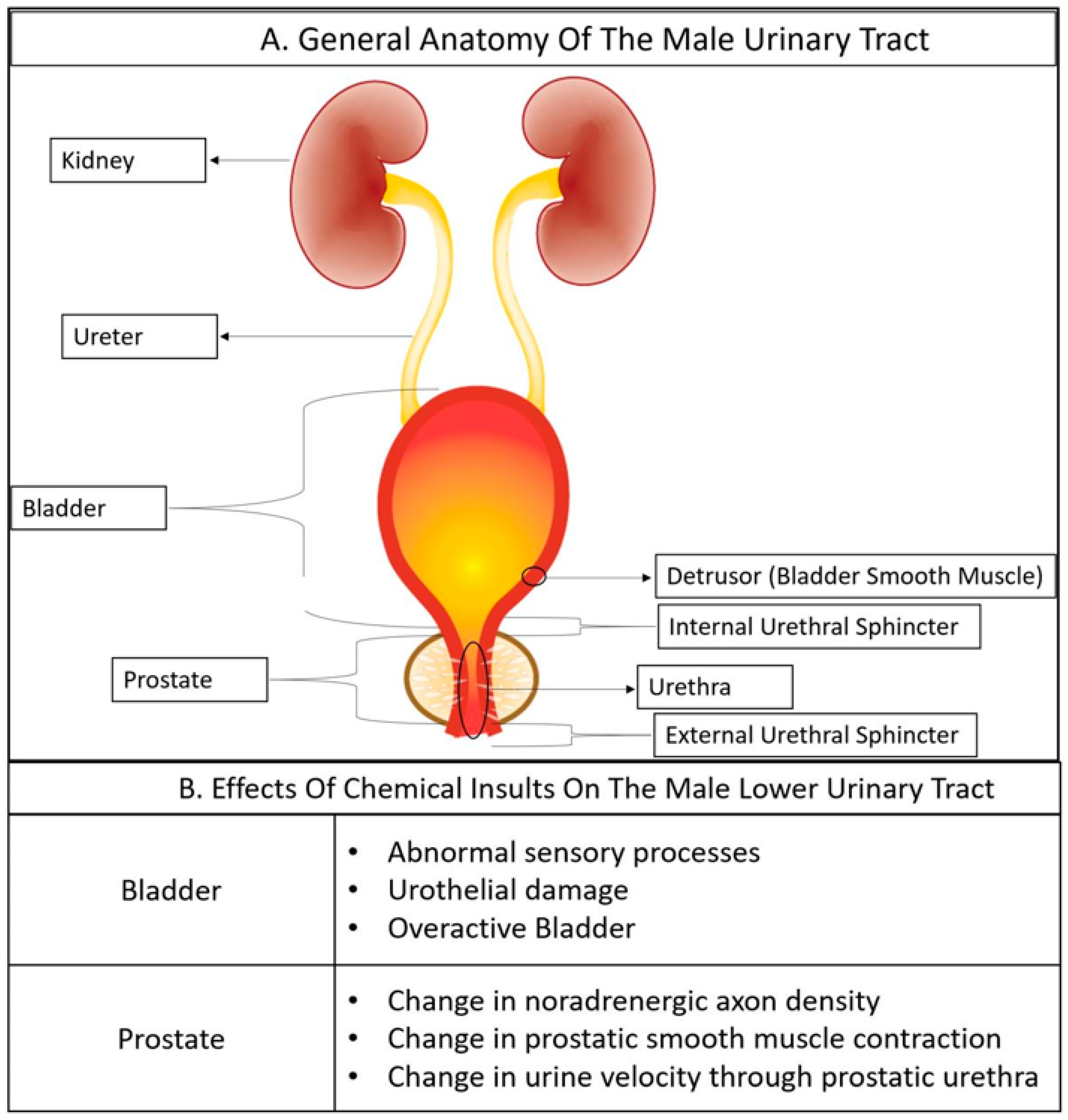 Increased Collagen Turnover Is a Feature of Fibromuscular