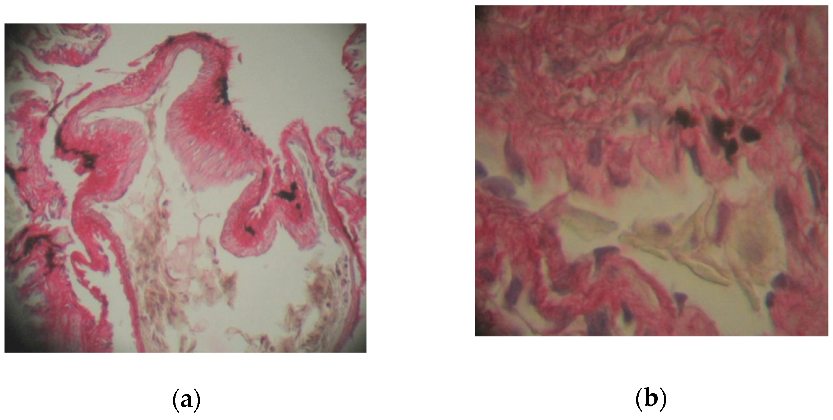 Toxics 10 00114 g005a 550