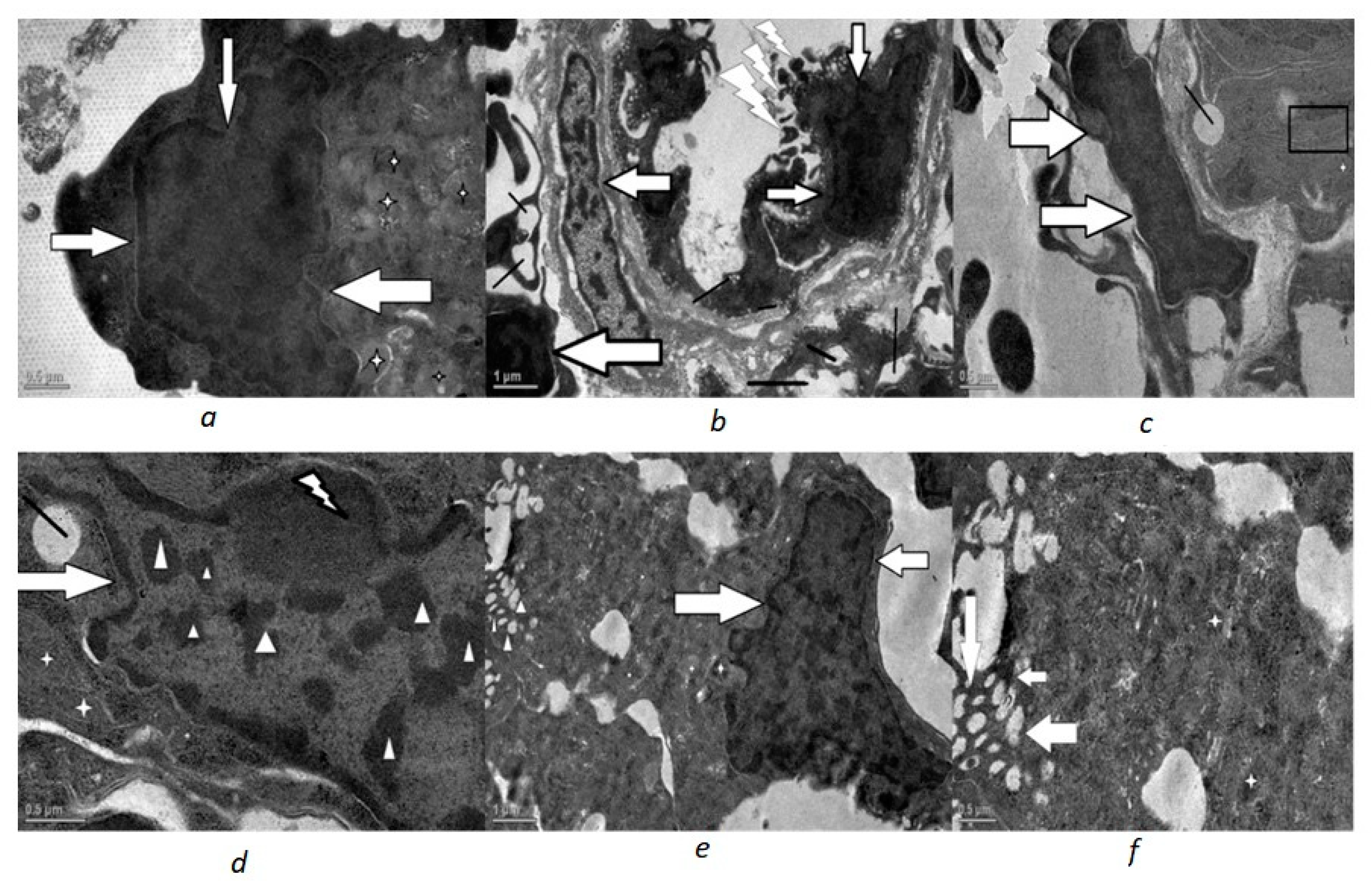 Toxics 10 00177 g003 550