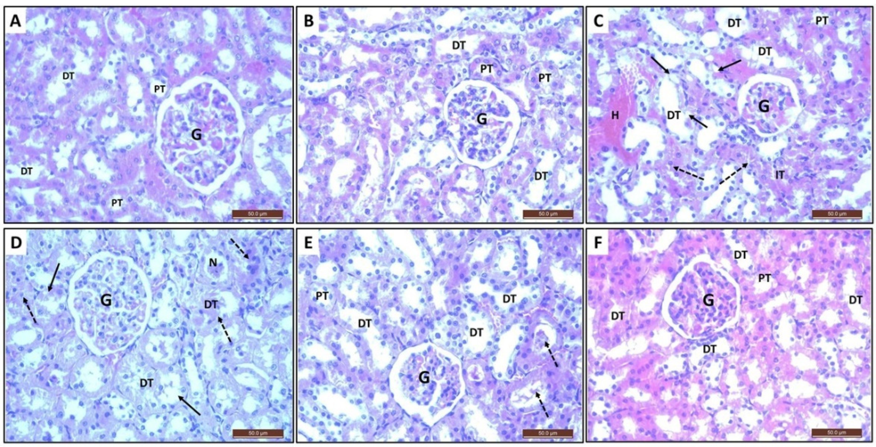Toxics 10 00526 g006 Toxics 10 00526 g006