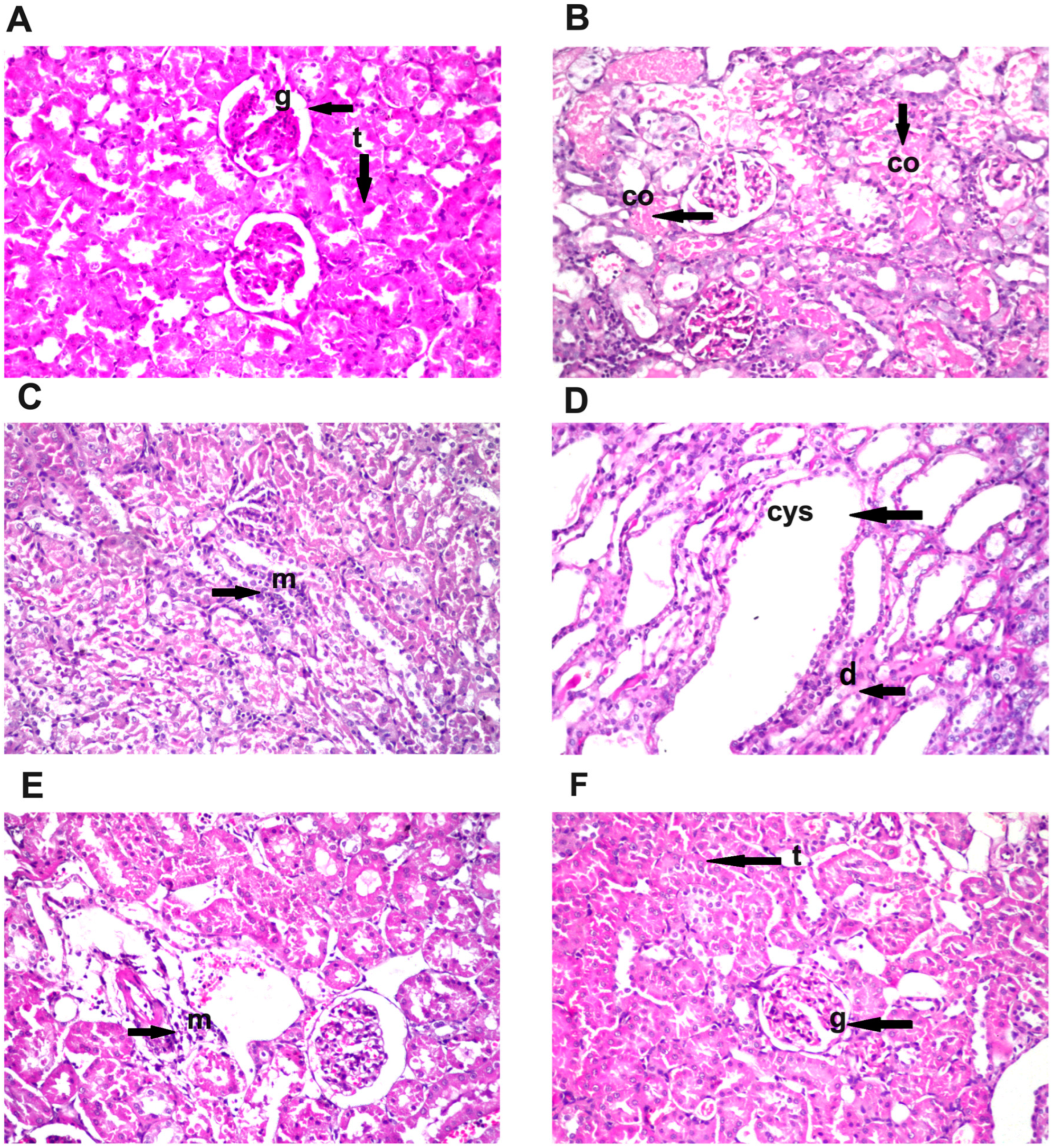 Diosmin Mitigates Gentamicin-Induced Nephrotoxicity in Rats
