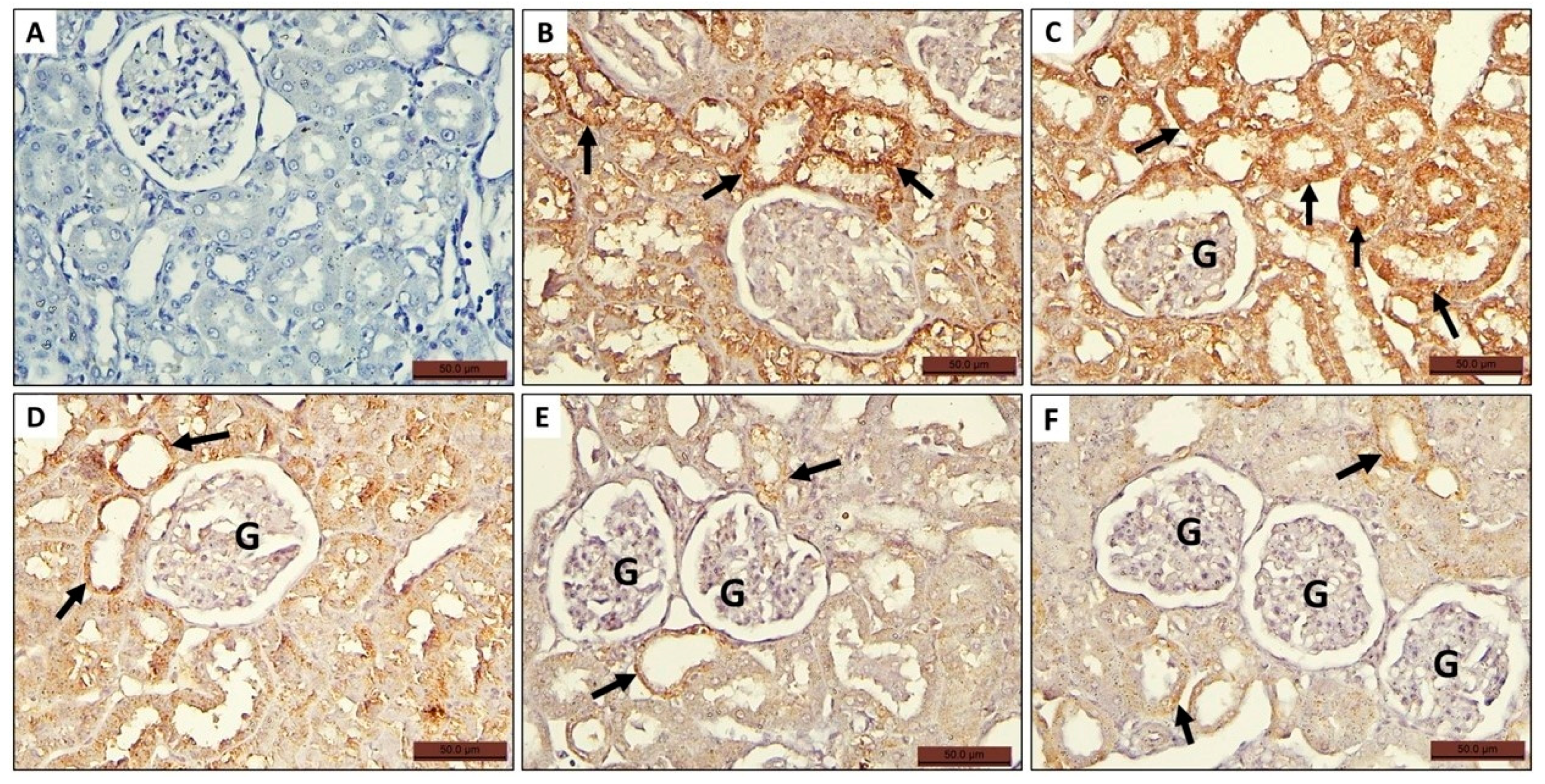 Toxics 11 00398 g006