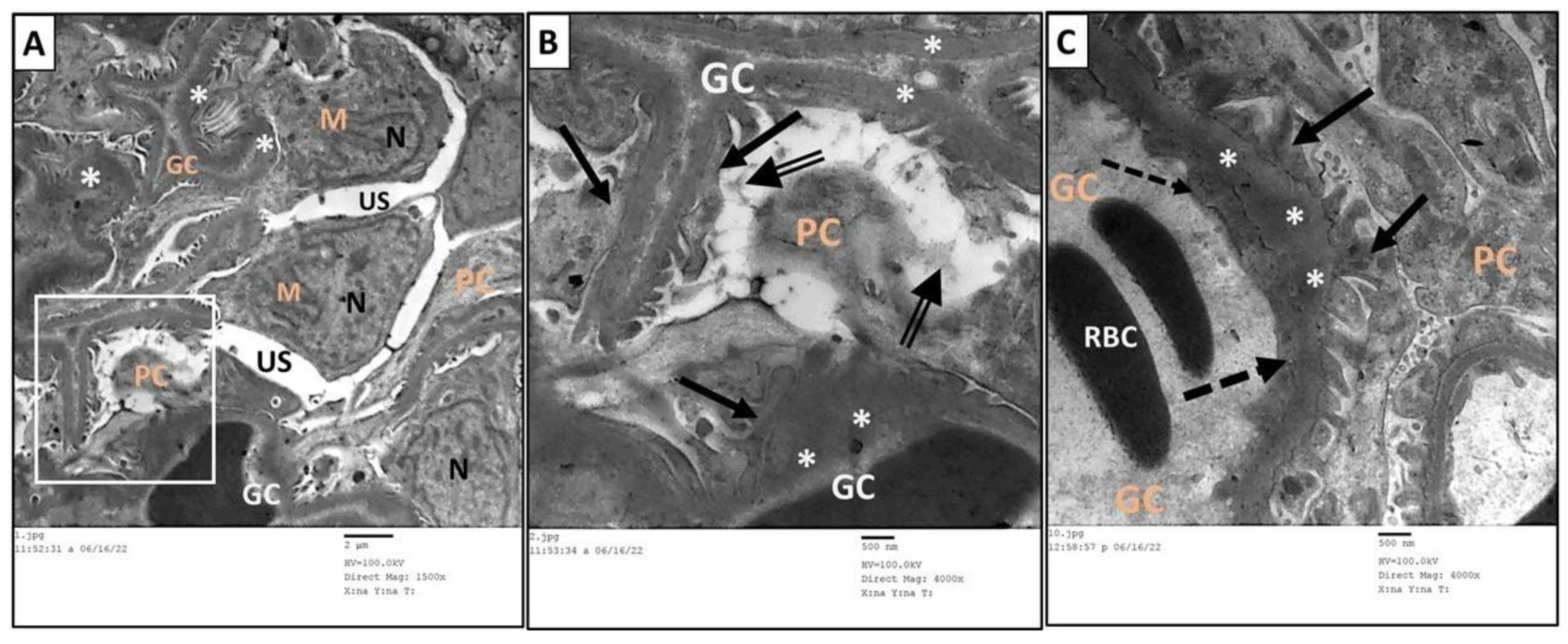 Toxics 11 00398 g011