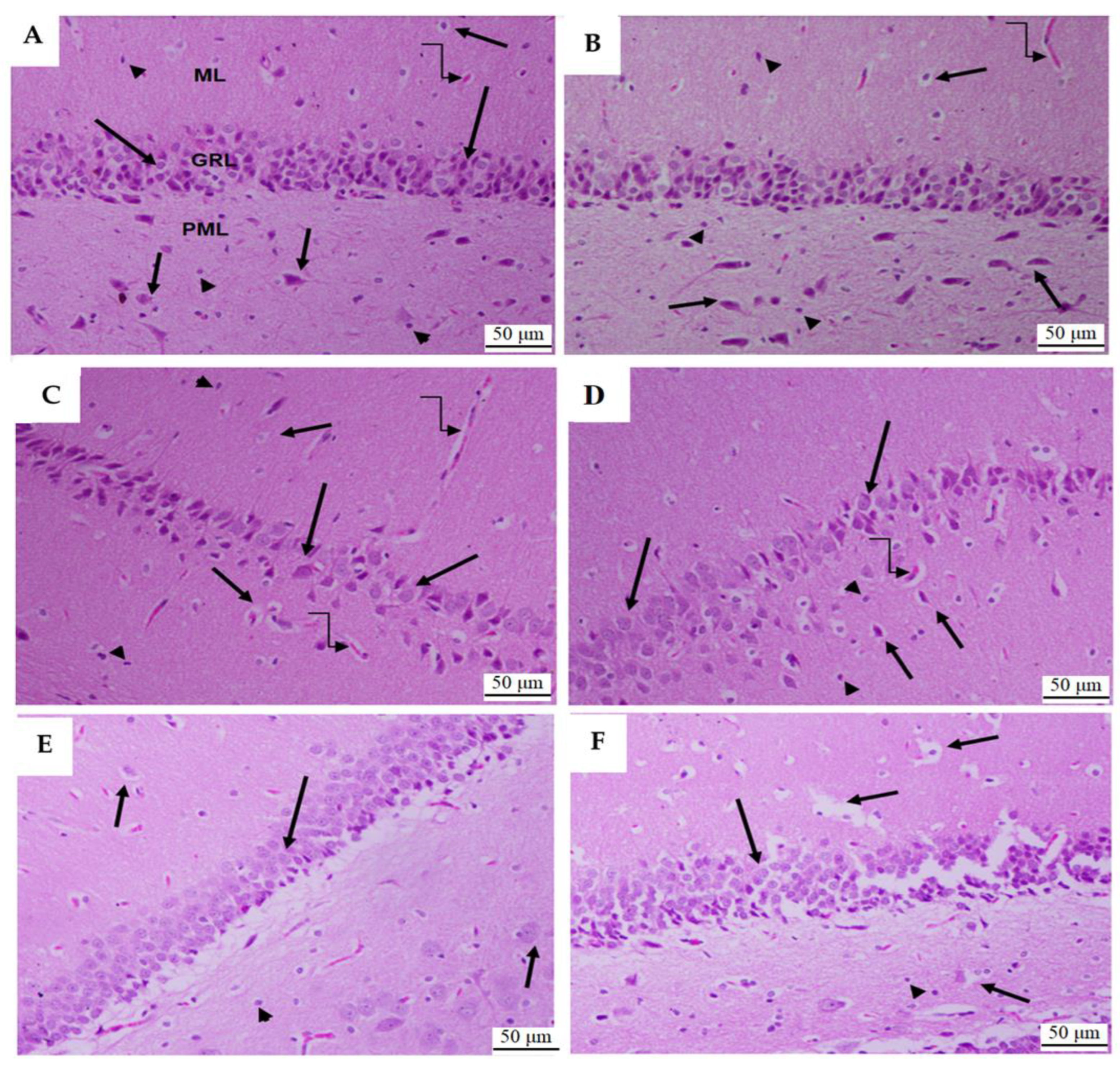 Toxics 11 00826 g011