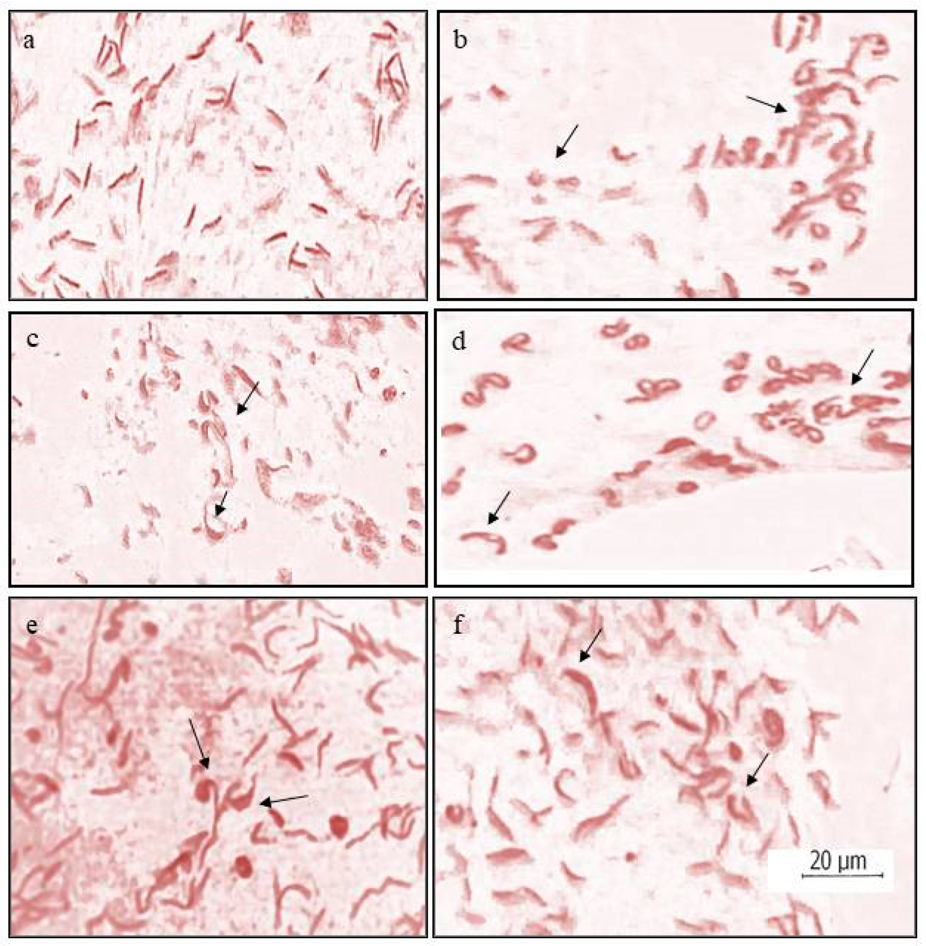 Toxics 11 00887 g004 Toxics 11 00887 g004
