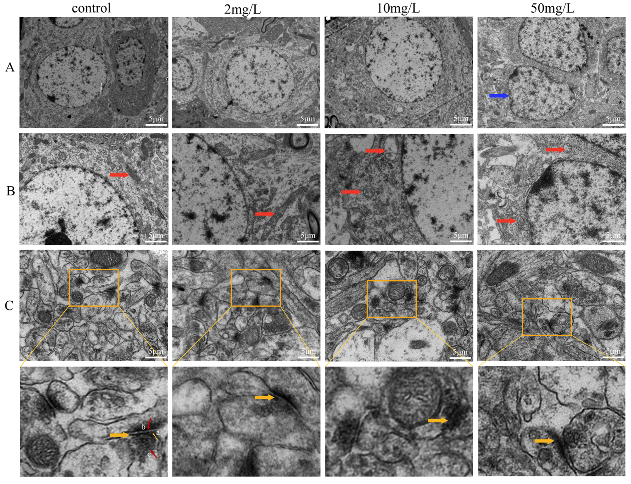 Toxics 11 00953 g003