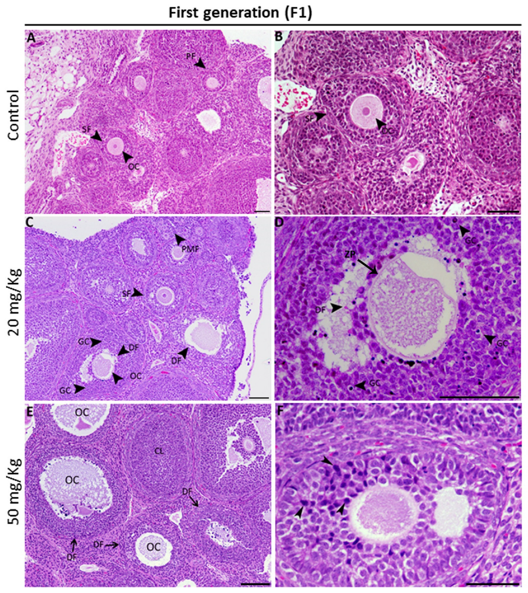 Toxics 11 00980 g003 Toxics 11 00980 g003