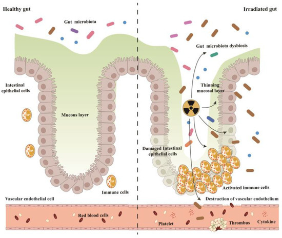 Radiation-Induced Intestinal Injury: Injury Mechanism and