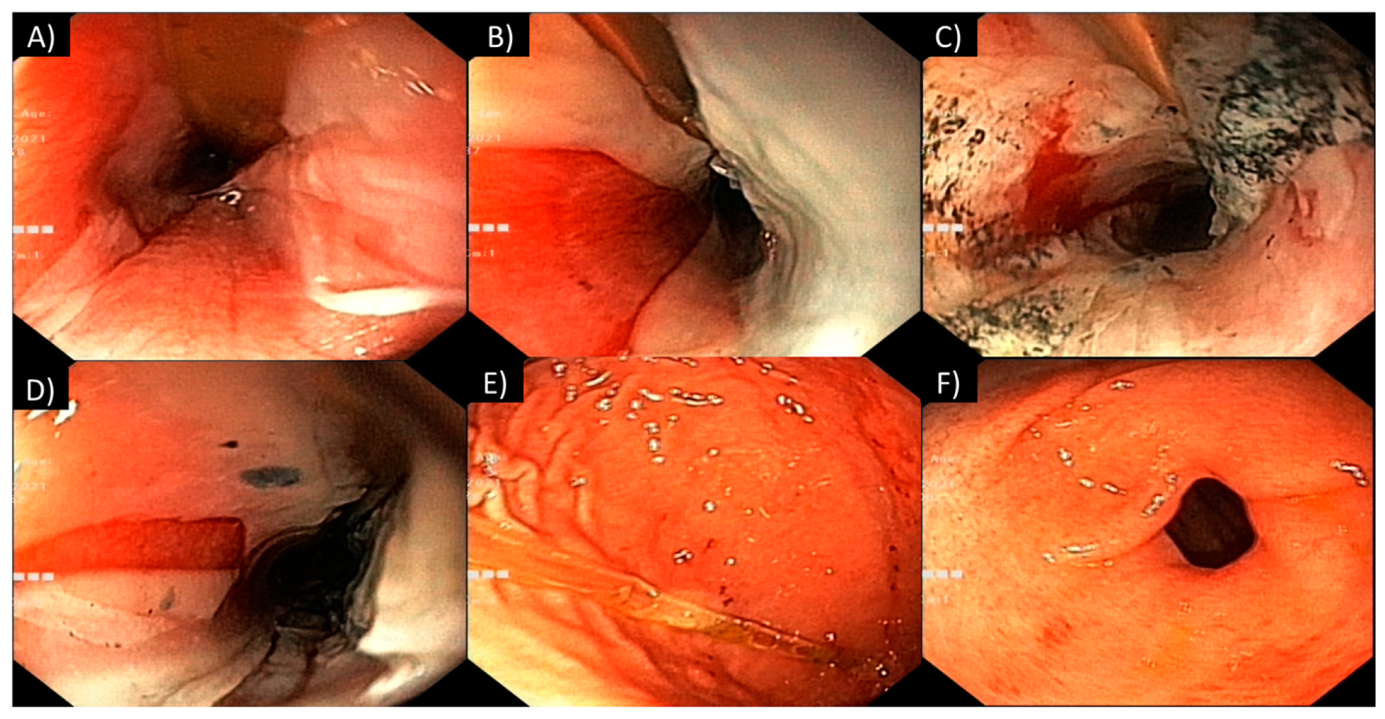 Toxics 12 00139 g003