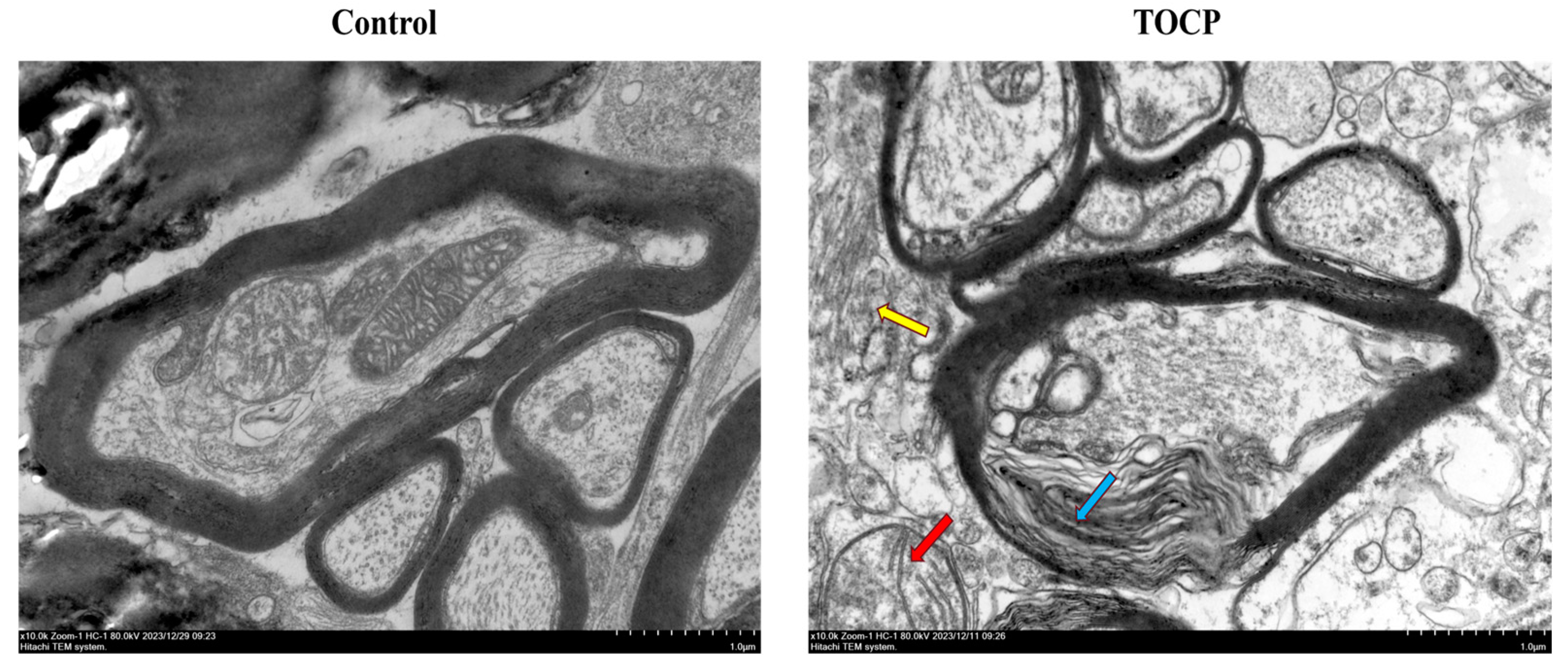 Toxics 12 00810 g003
