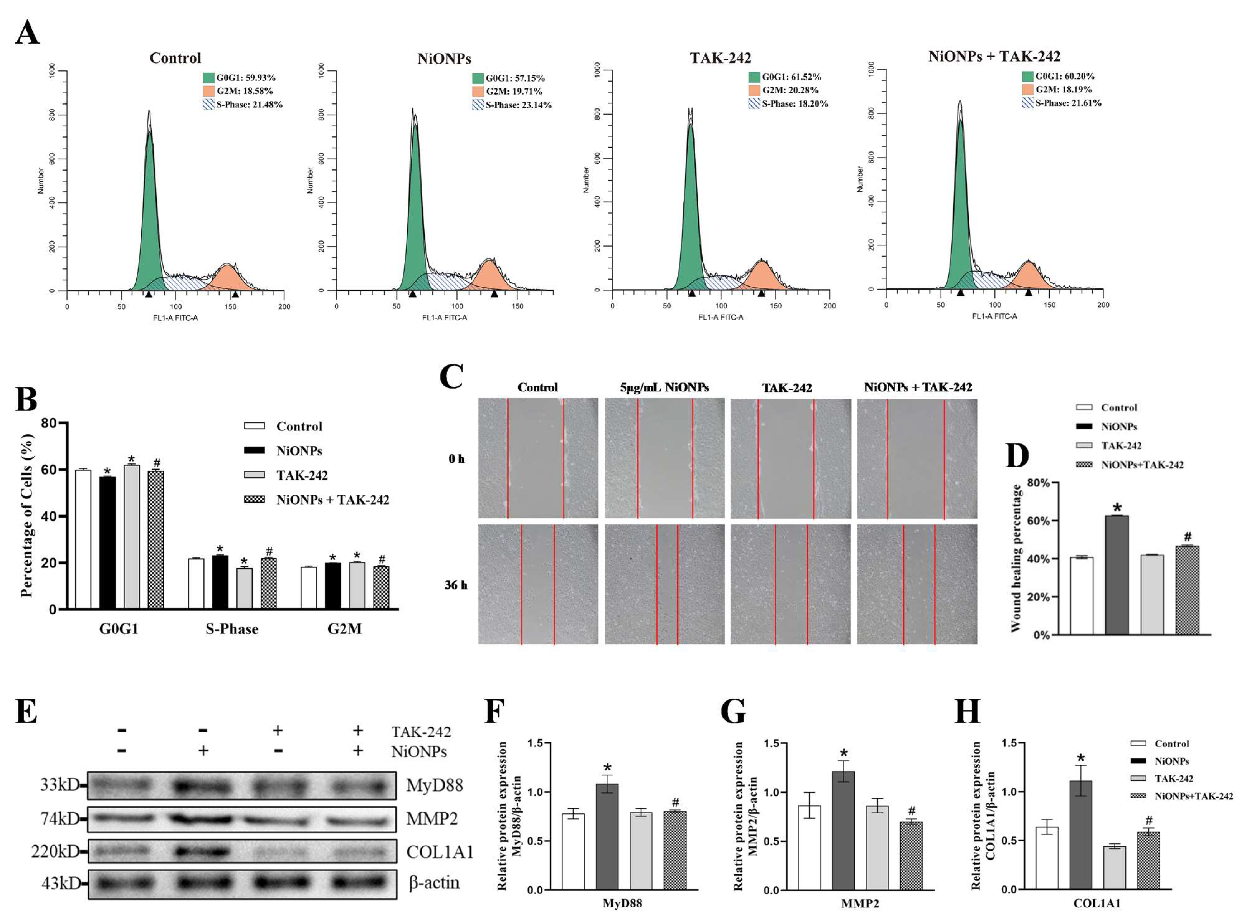 Hsa_circ_0001944 Regulates FXR/TLR4 Pathway and Ferroptosis