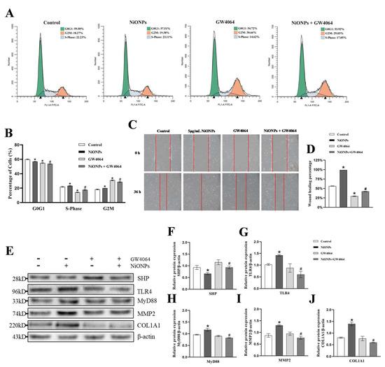 Hsa_circ_0001944 Regulates FXR/TLR4 Pathway and Ferroptosis to