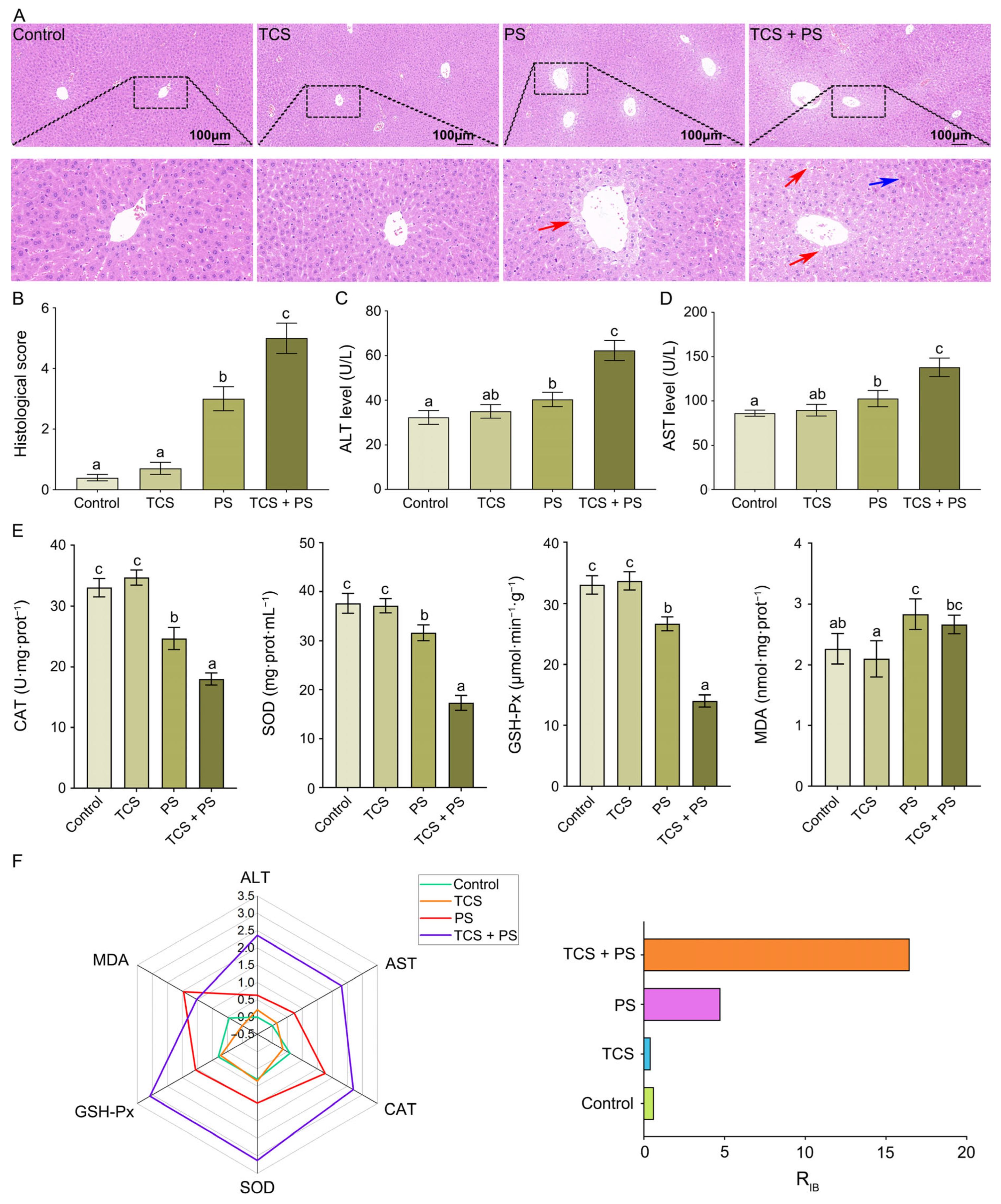 Toxics 13 00977 g005