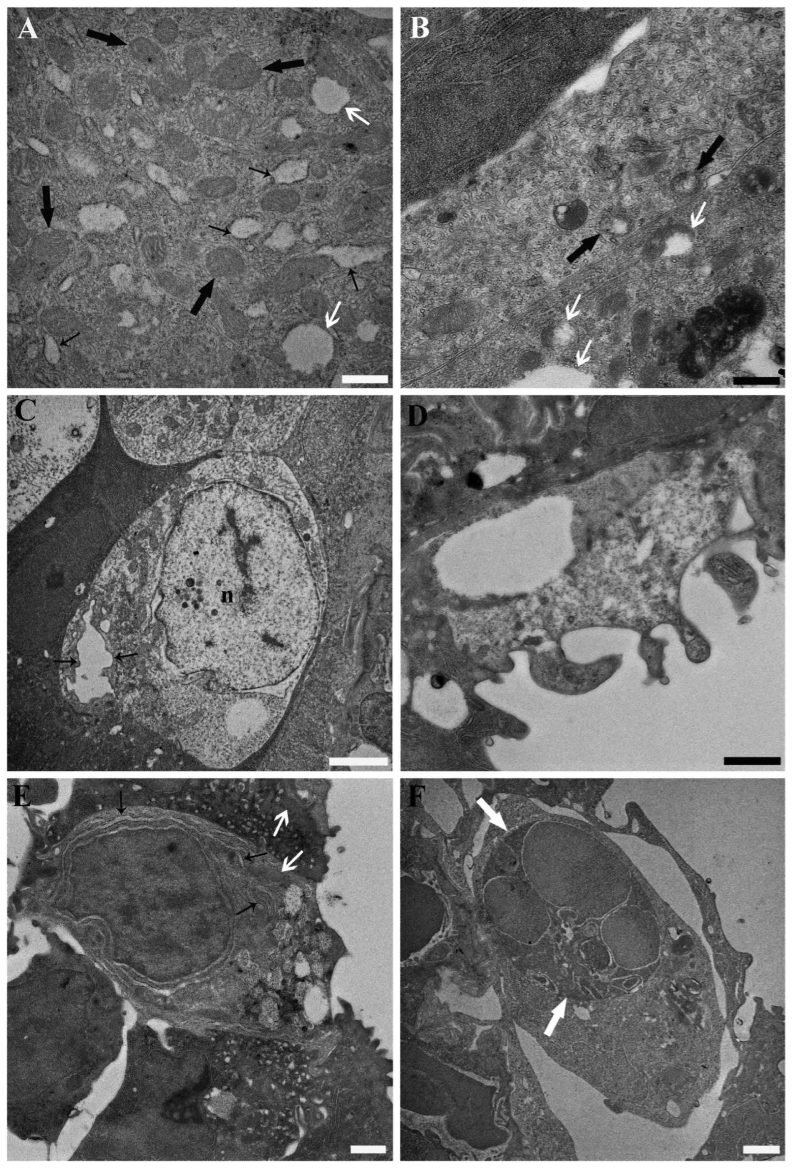 Toxics 13 01020 g003