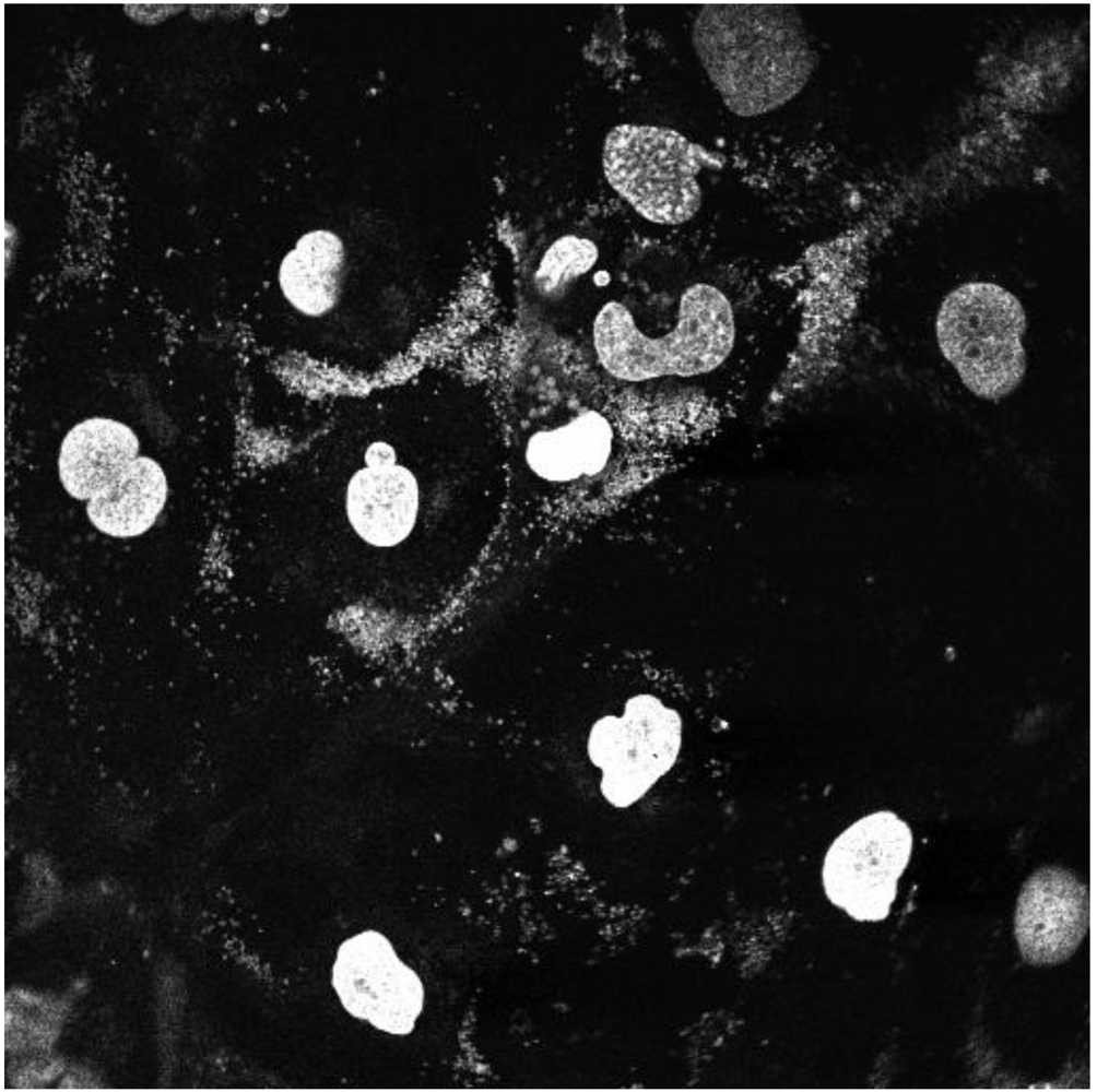 Toxins 02 01318 g006 1024