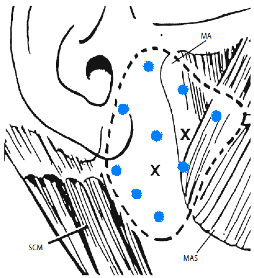 Toxins | Free Full-Text | Sialorrhea: Anatomy, Pathophysiology and Treatment with ...1024 x 1121