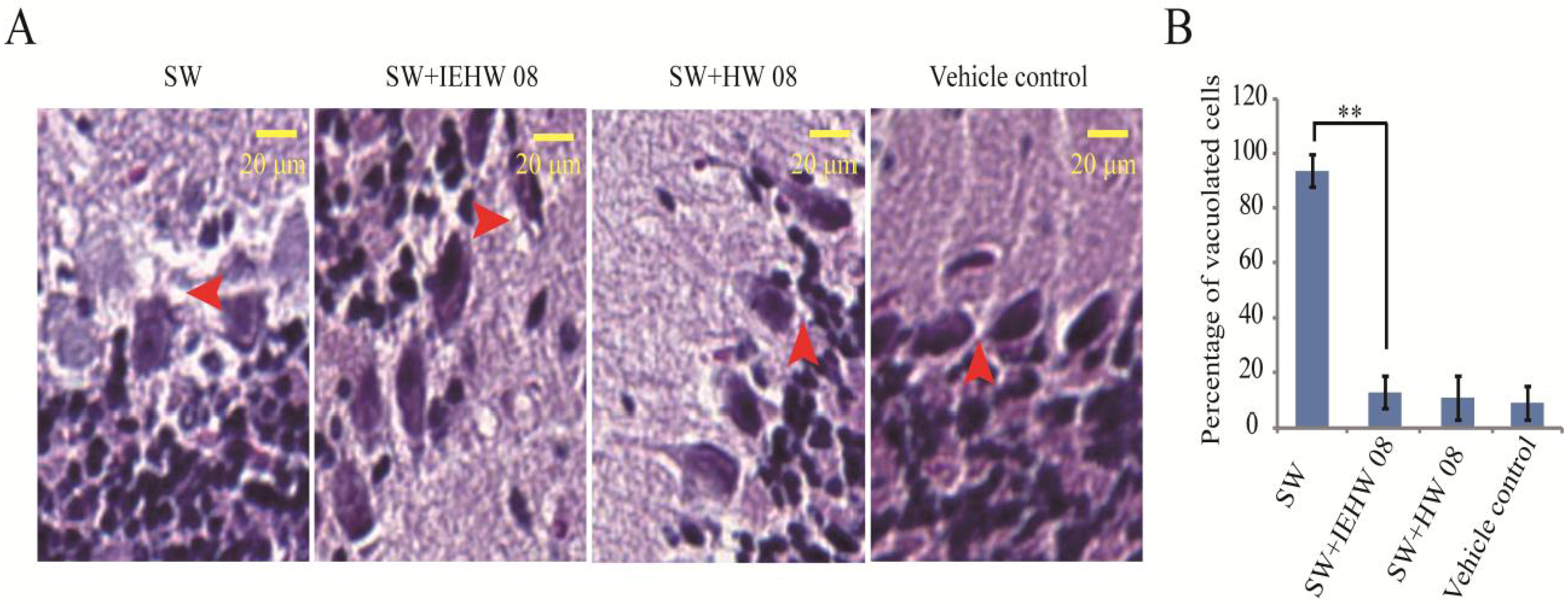 Toxins 05 02161 g006