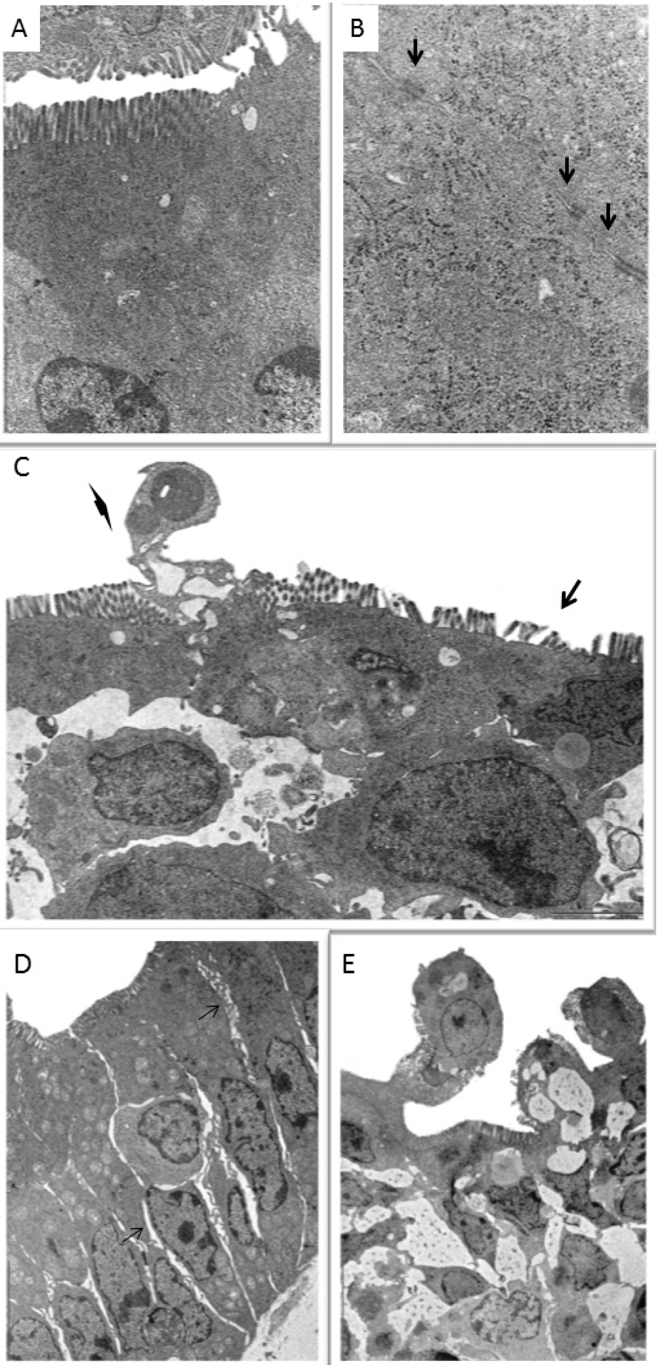 Toxins 05 02341 g002