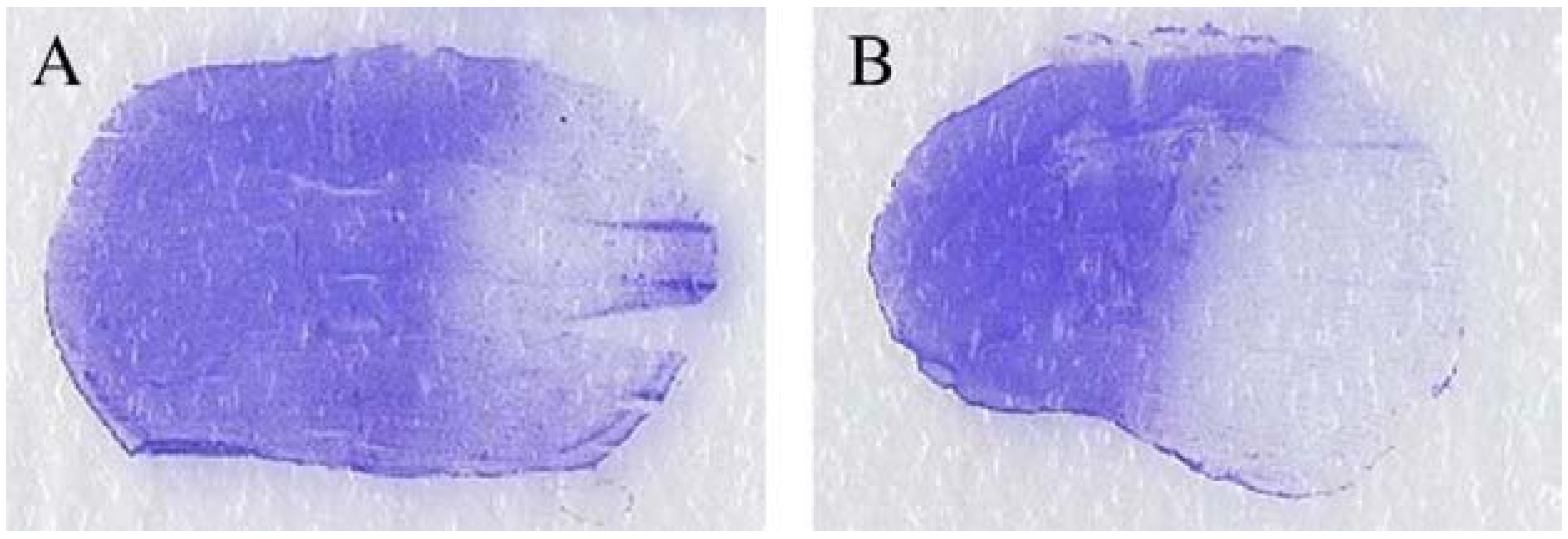 Toxins 06 00180 g004