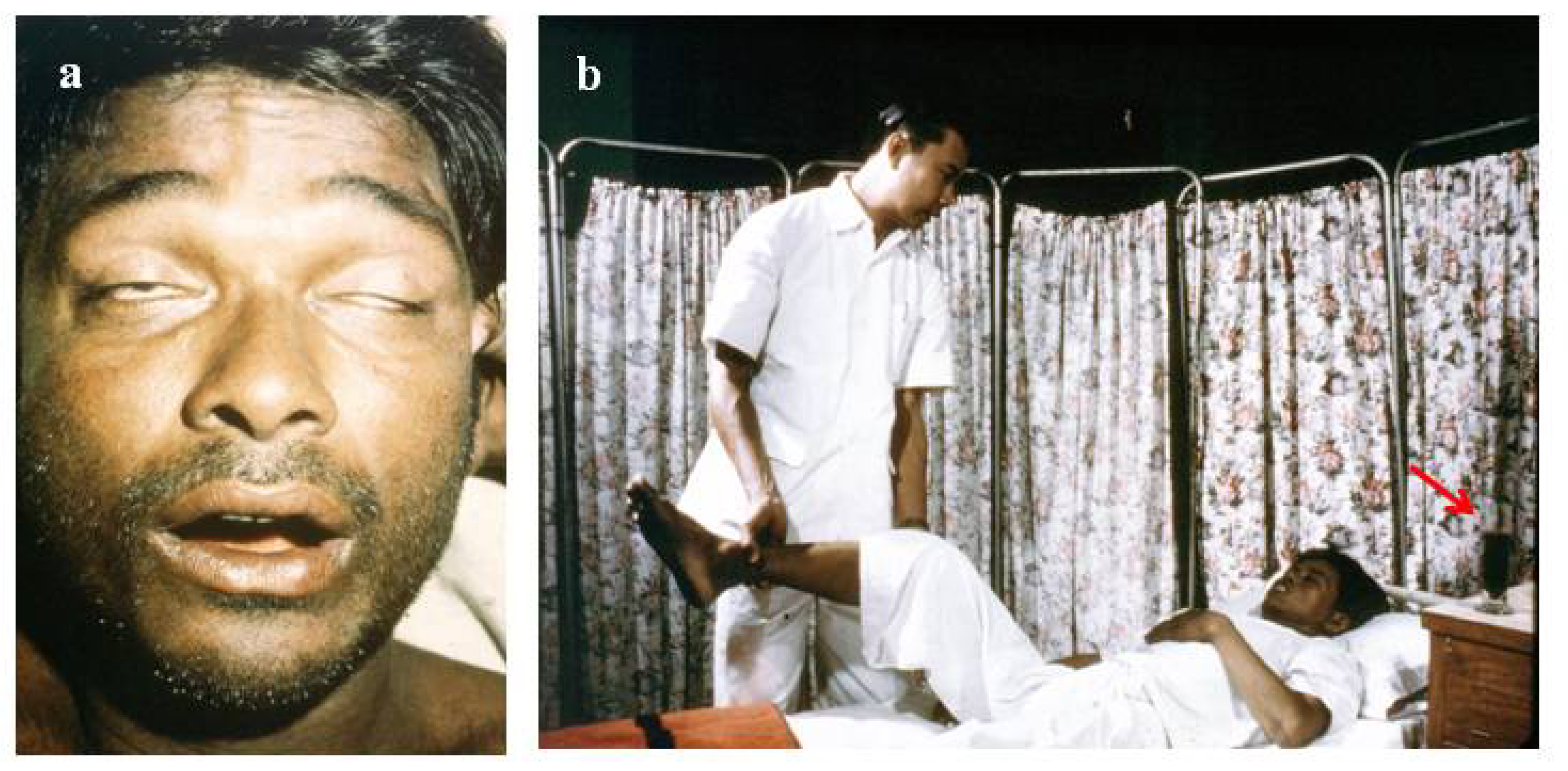 Toxins 06 01667 g003