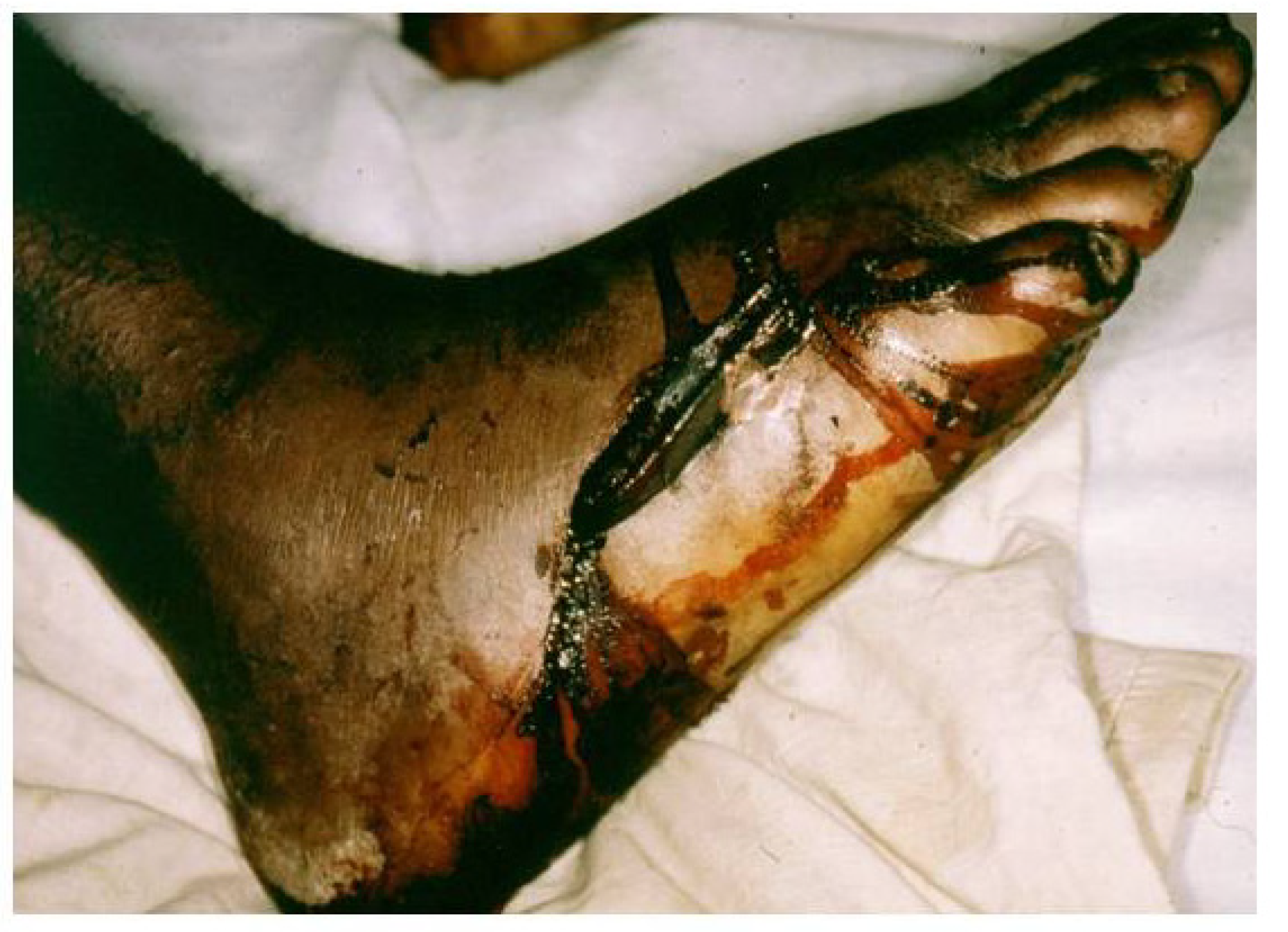 Toxins 06 01667 g015